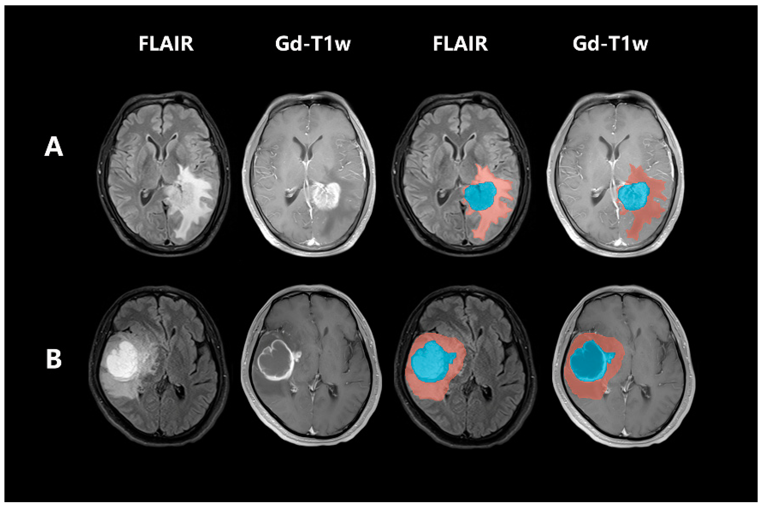 Brainsci 13 00548 g002 Brainsci 13 00548 g002