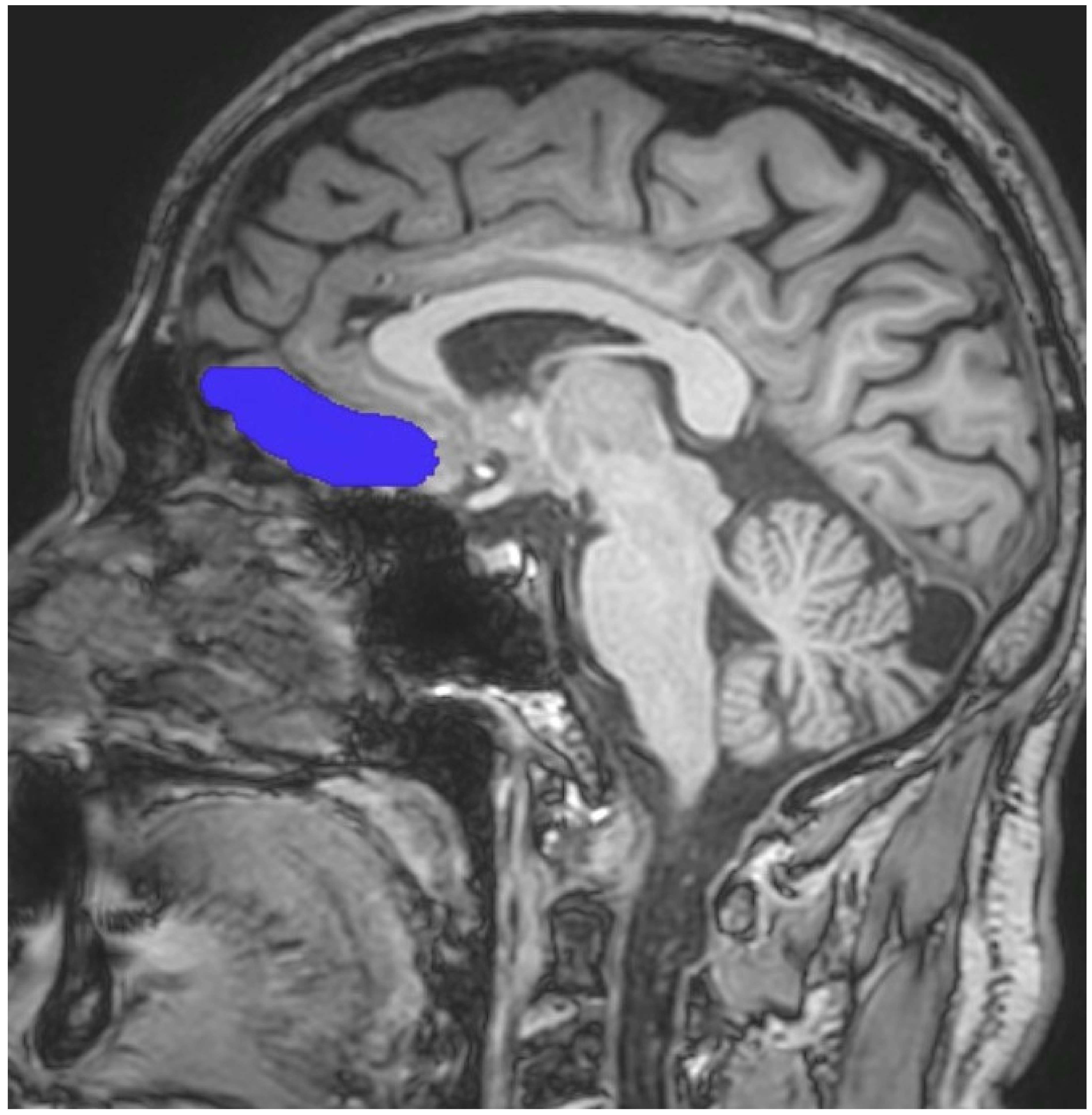 Brainsci 13 00552 g001