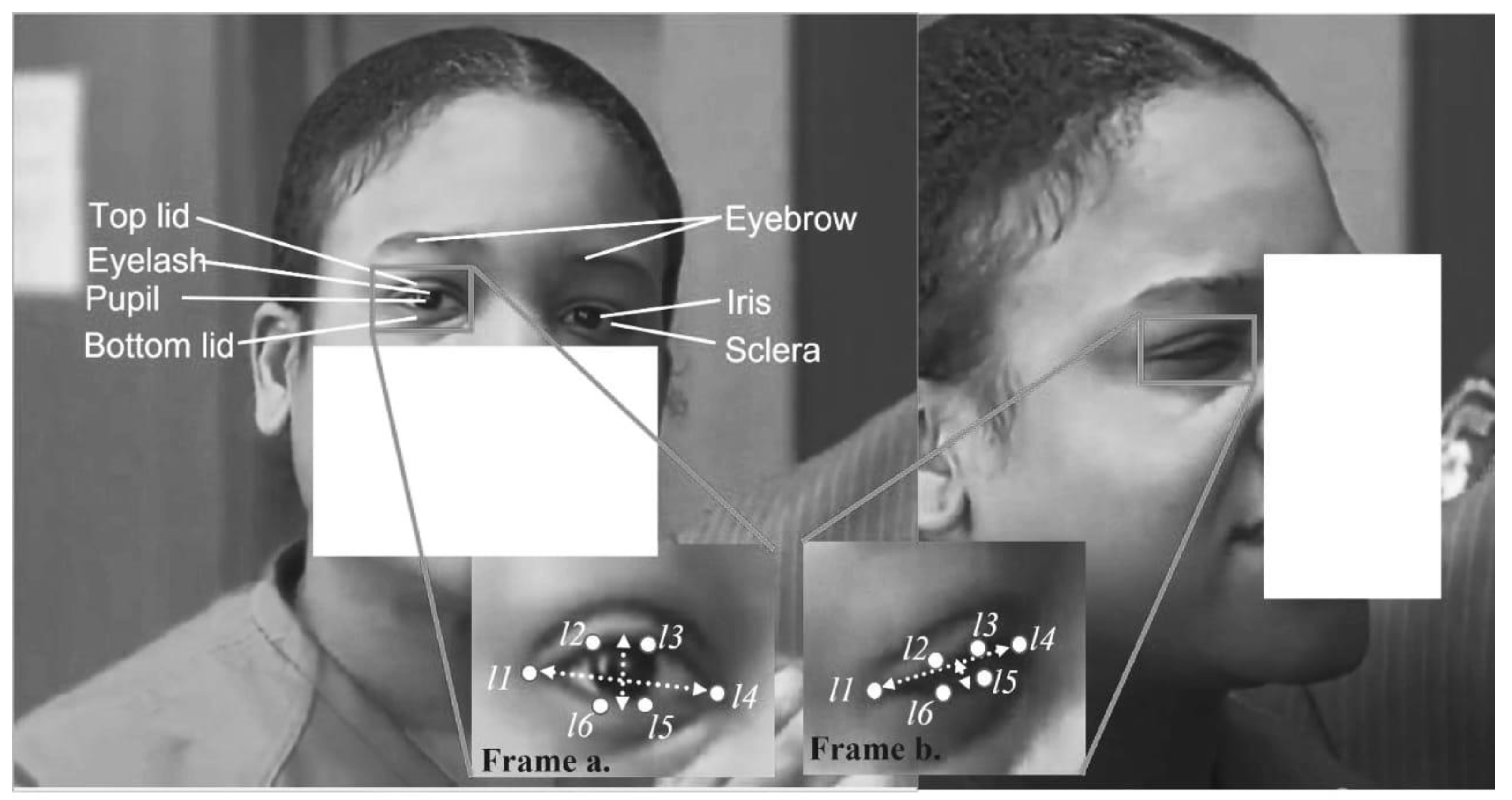 Brainsci 13 00555 g004