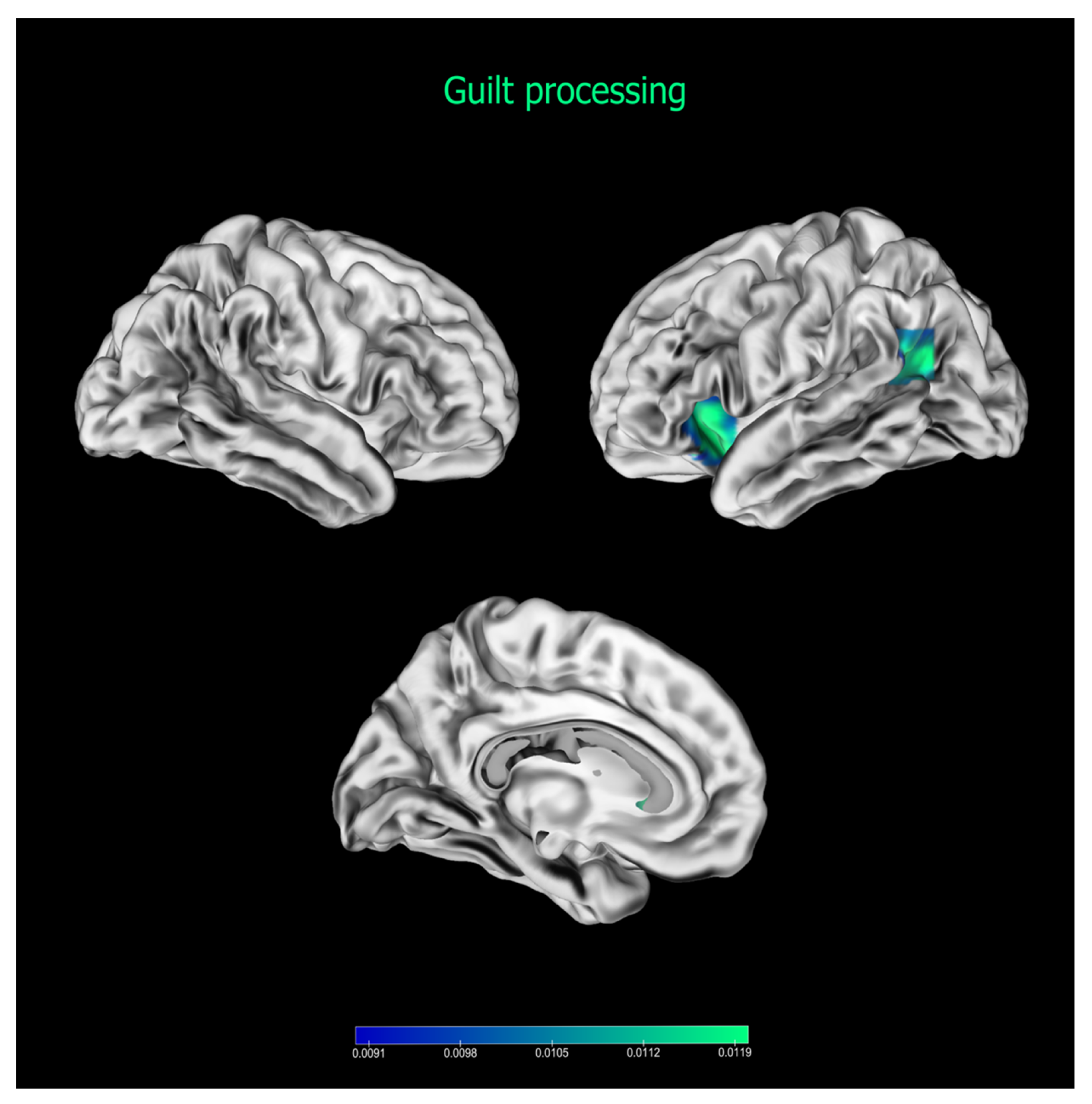 Brainsci 13 00559 g002