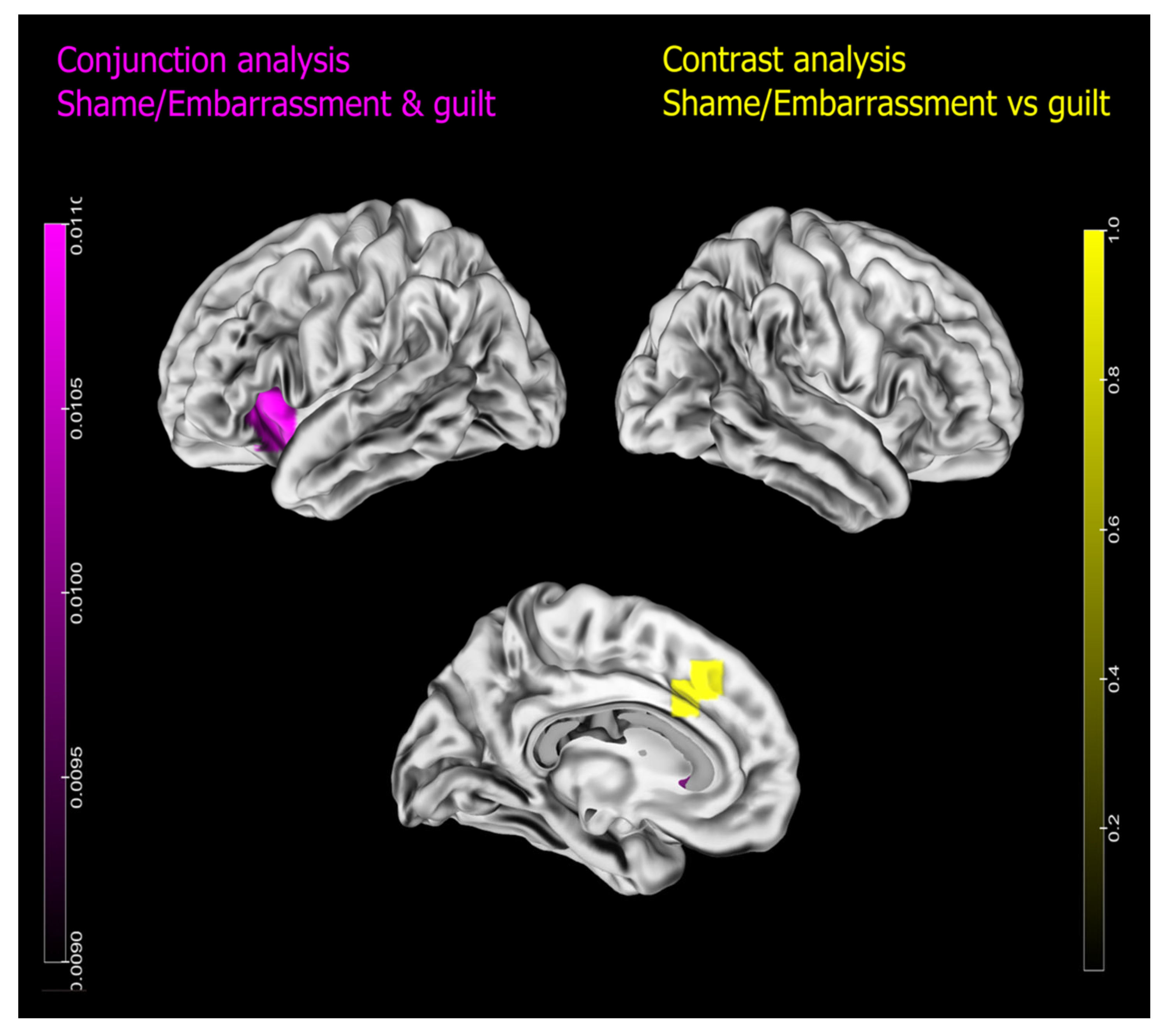 Brainsci 13 00559 g003