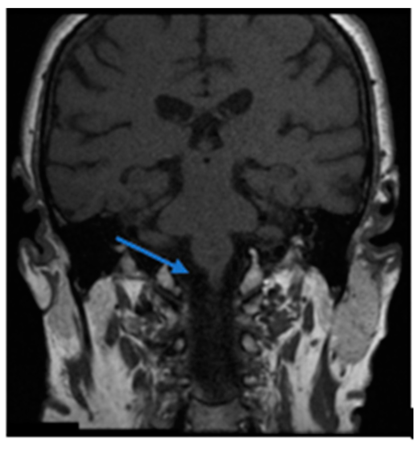 Brainsci 13 00562 g001