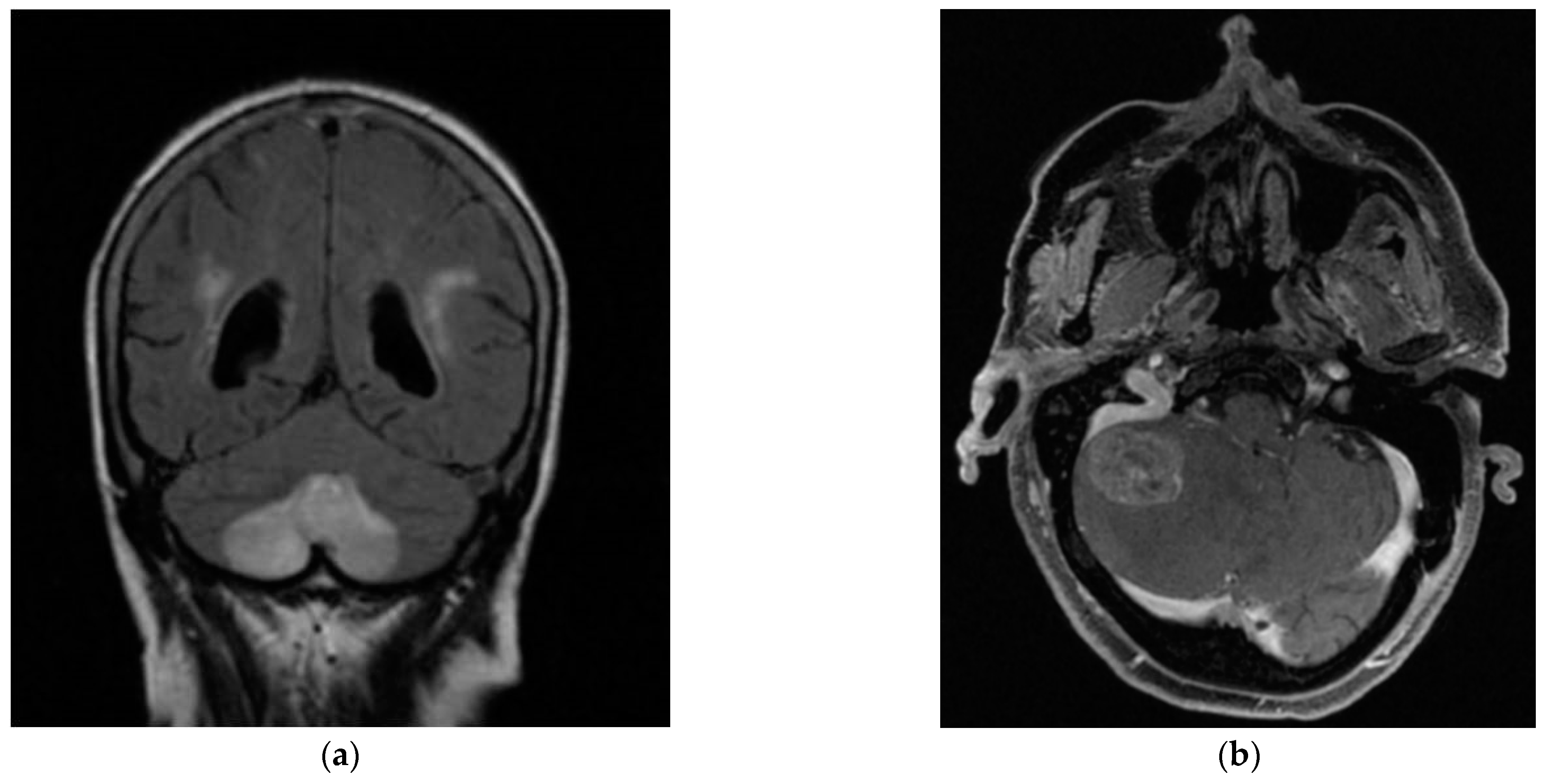 Brainsci 13 00562 g002