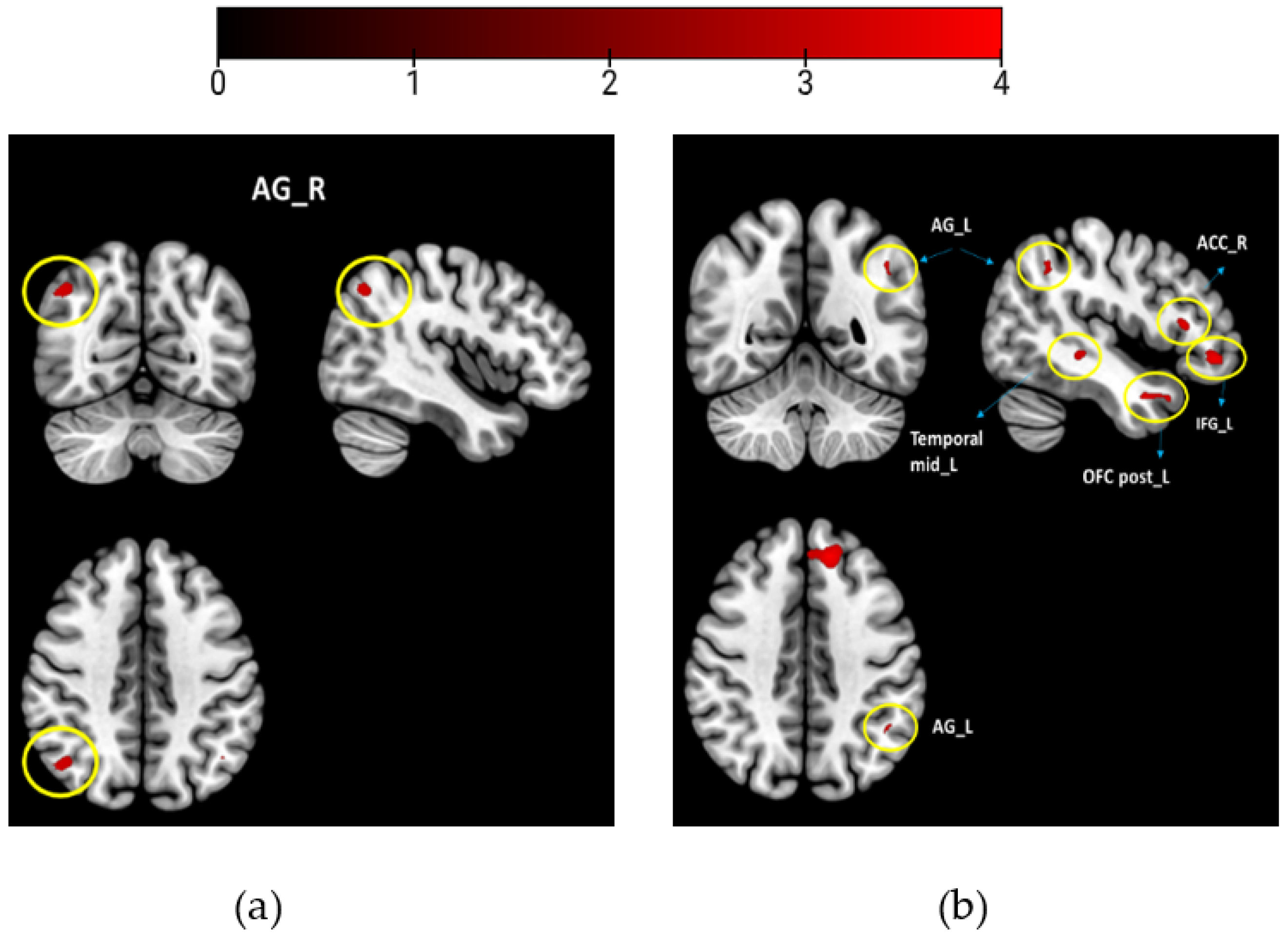 Brainsci 13 00576 g002
