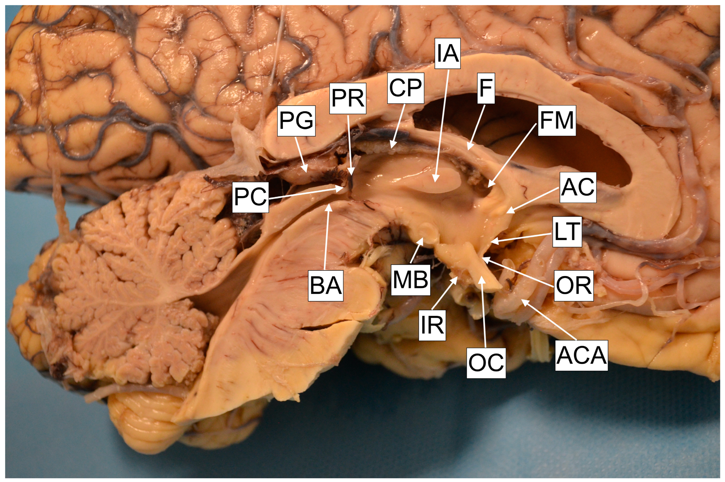 Brainsci 13 00580 g004 Brainsci 13 00580 g004