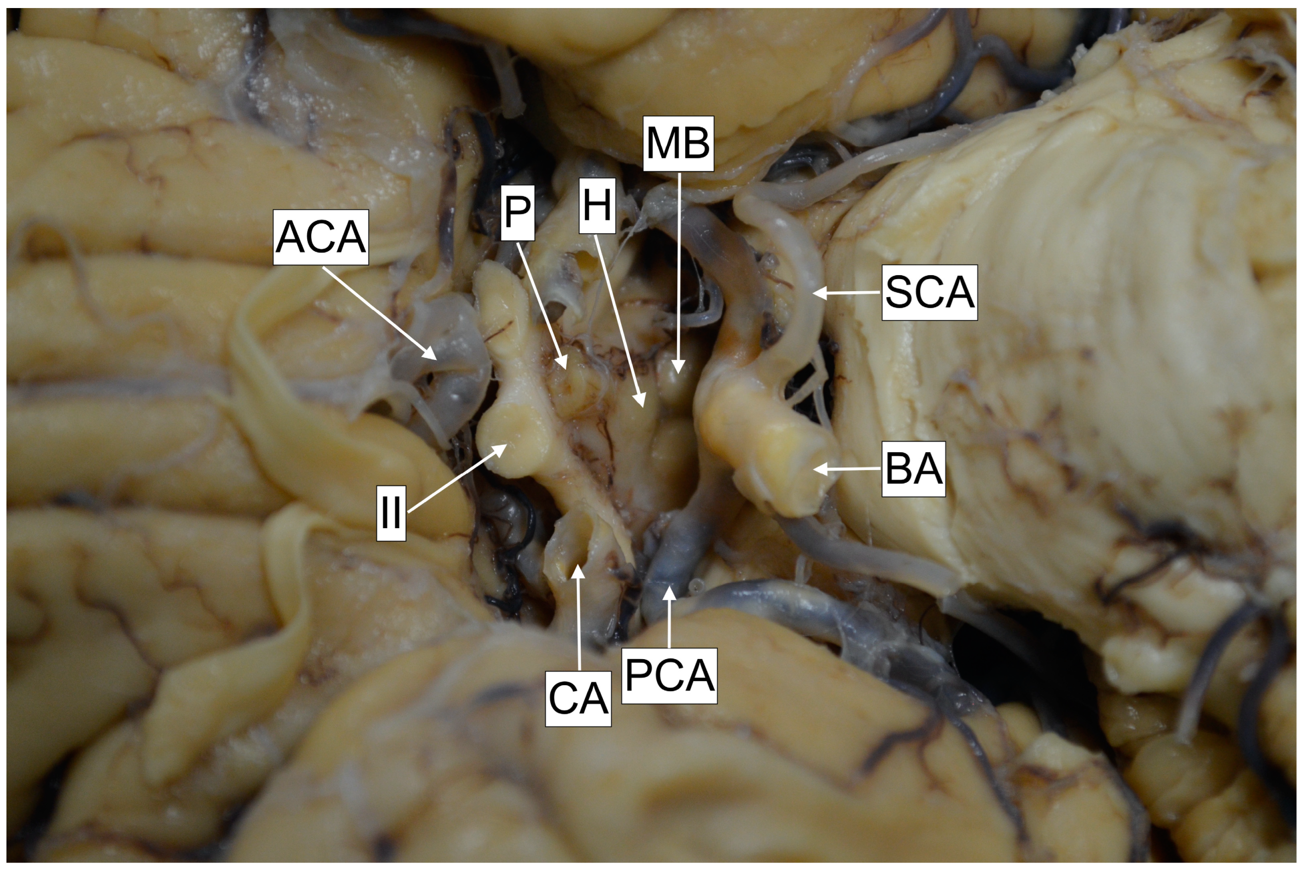 Brainsci 13 00580 g005 Brainsci 13 00580 g005