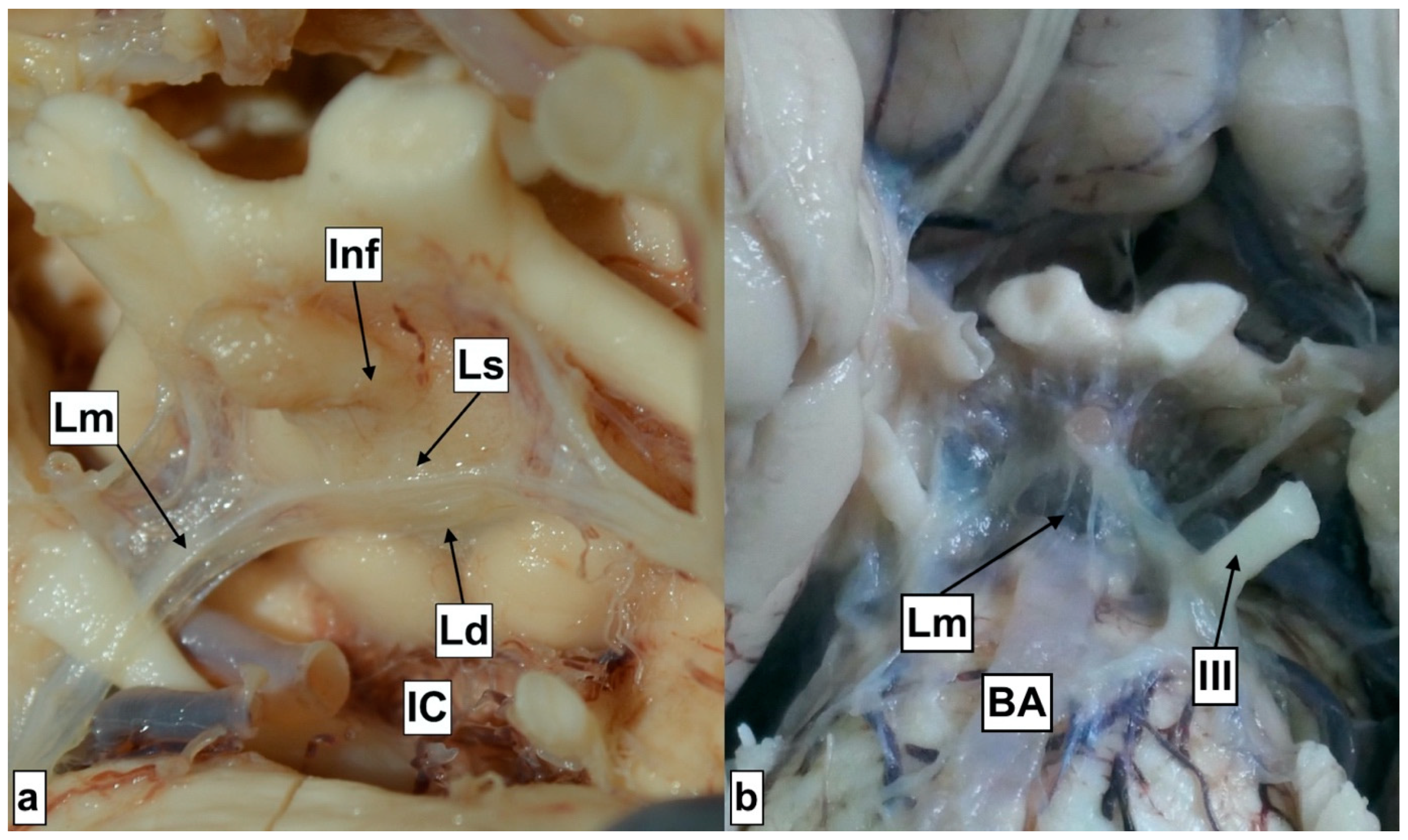 Brainsci 13 00580 g006 Brainsci 13 00580 g006