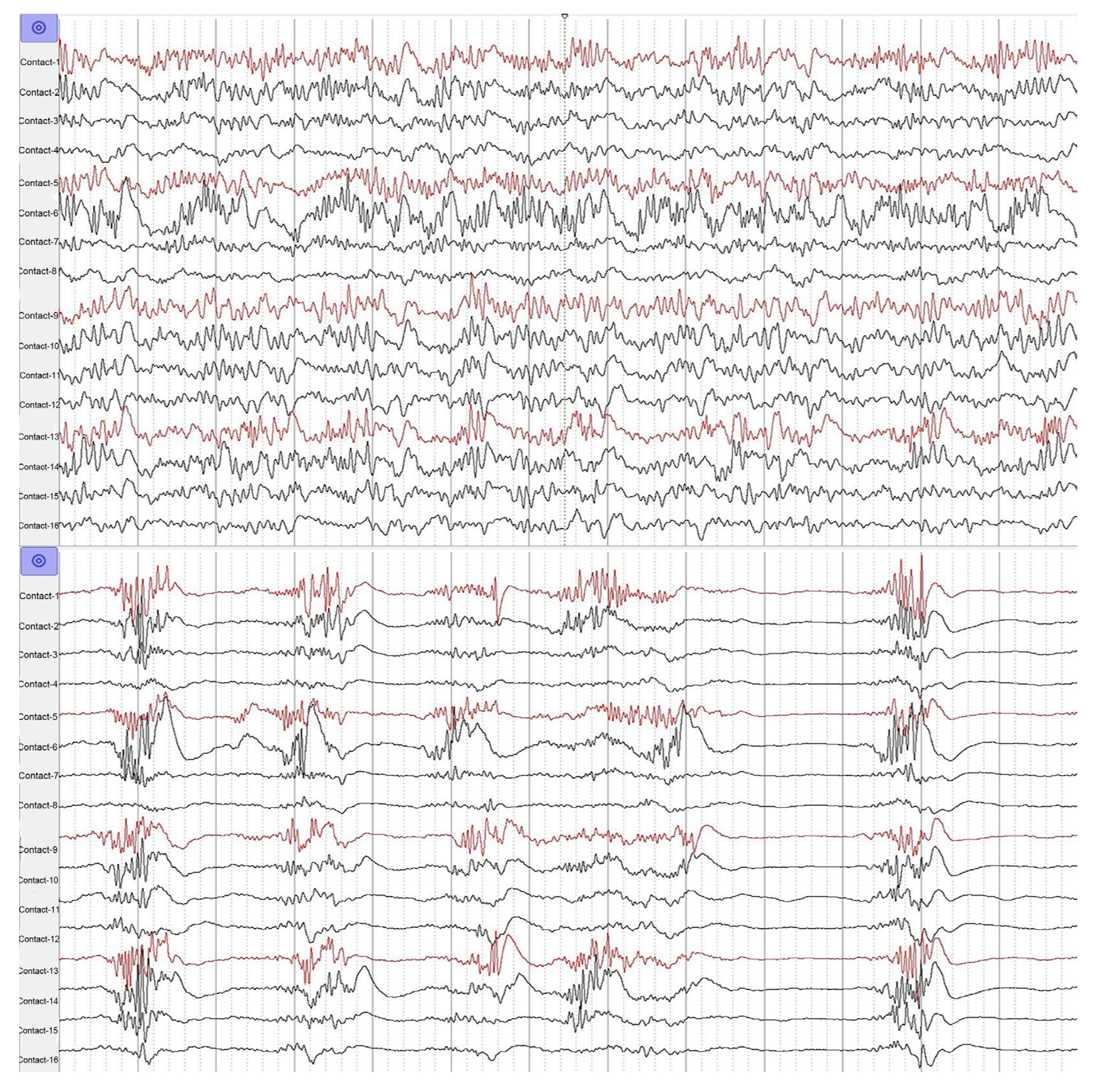 Brainsci 13 00597 g004