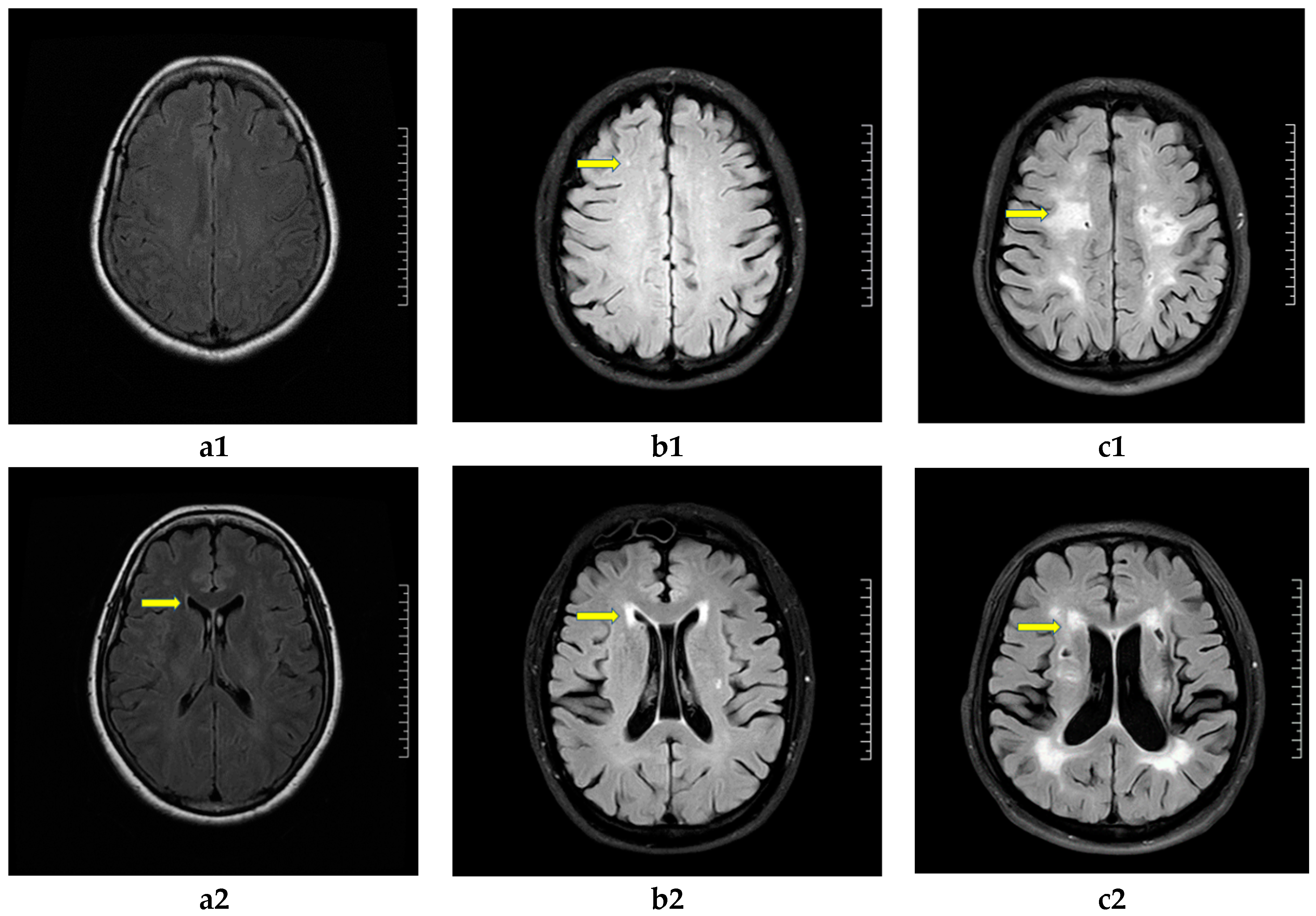Brainsci 13 00616 g001