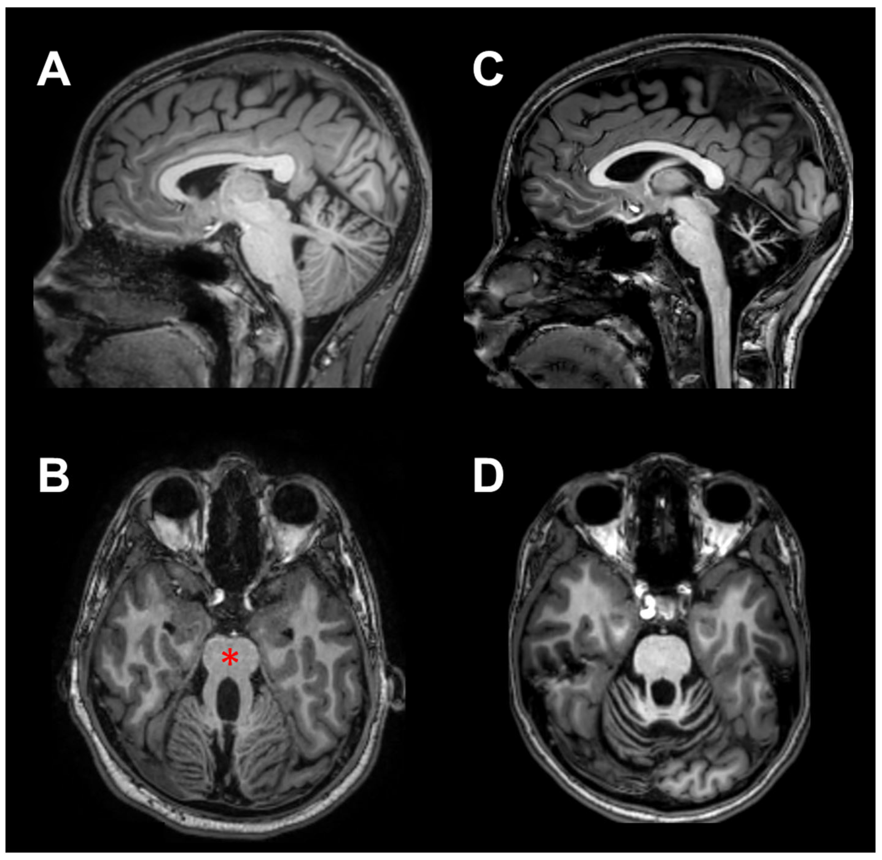 Brainsci 13 00620 g001