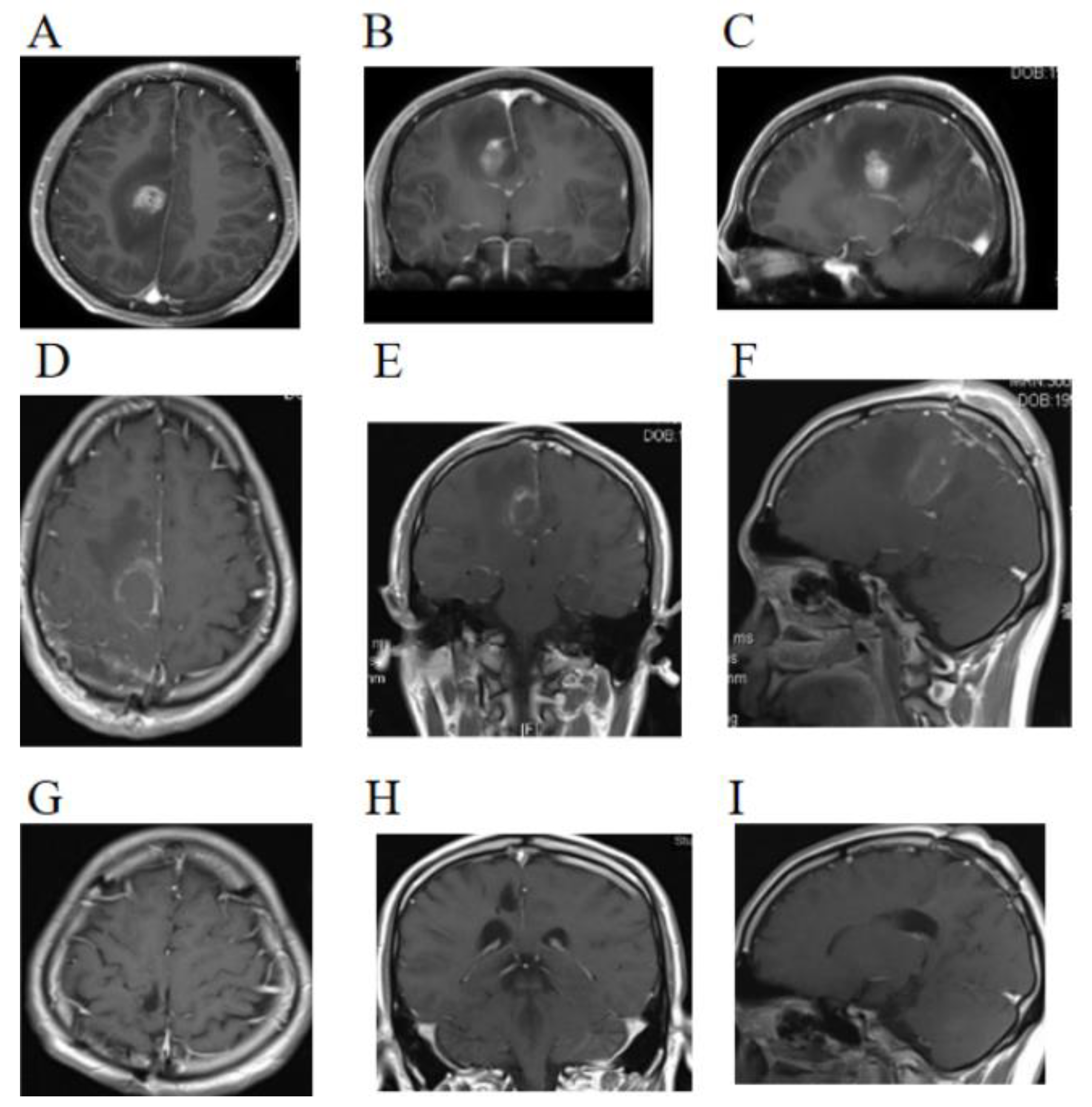 Brainsci 13 00633 g001 Brainsci 13 00633 g001