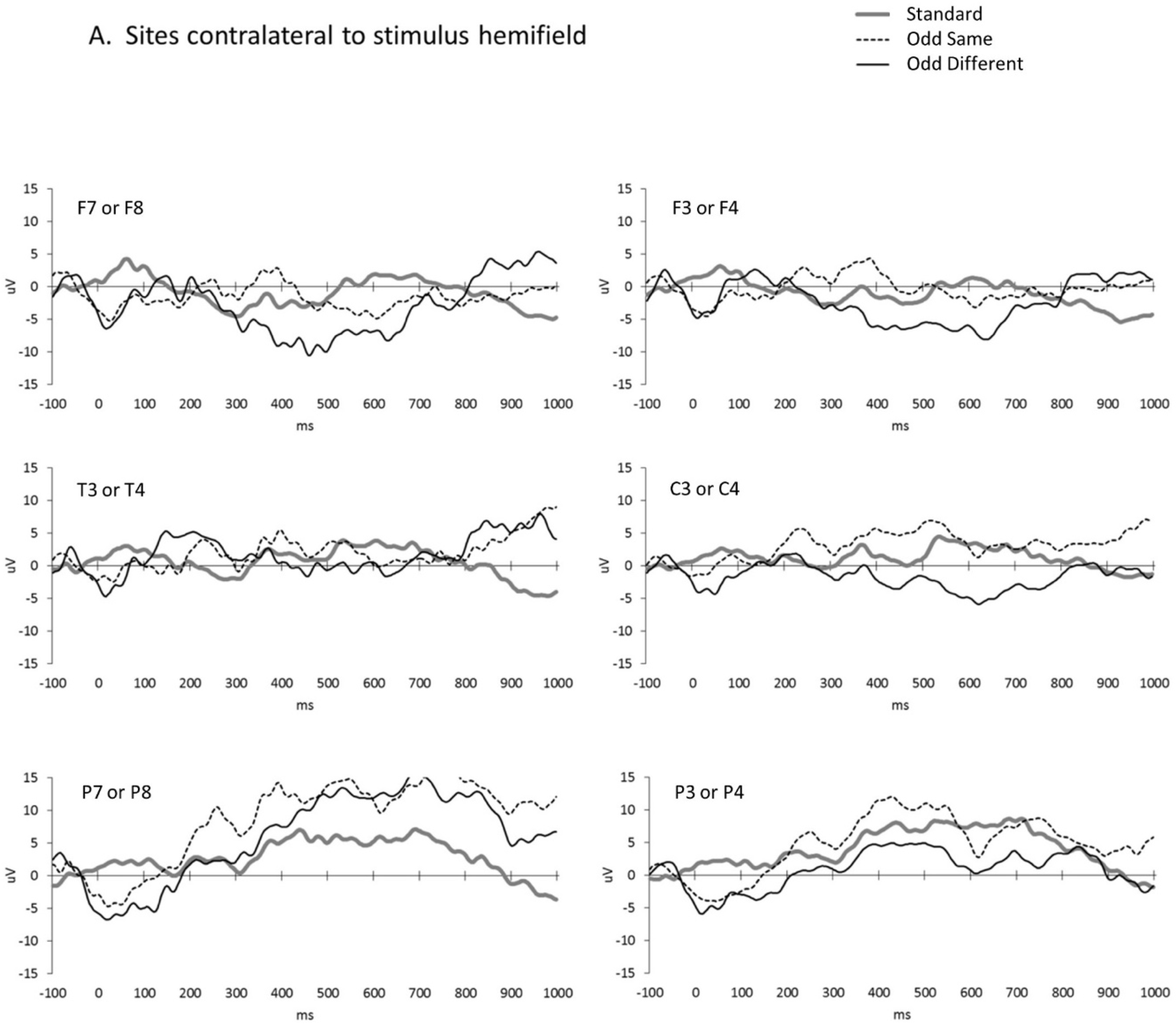 Brainsci 13 00647 g002a