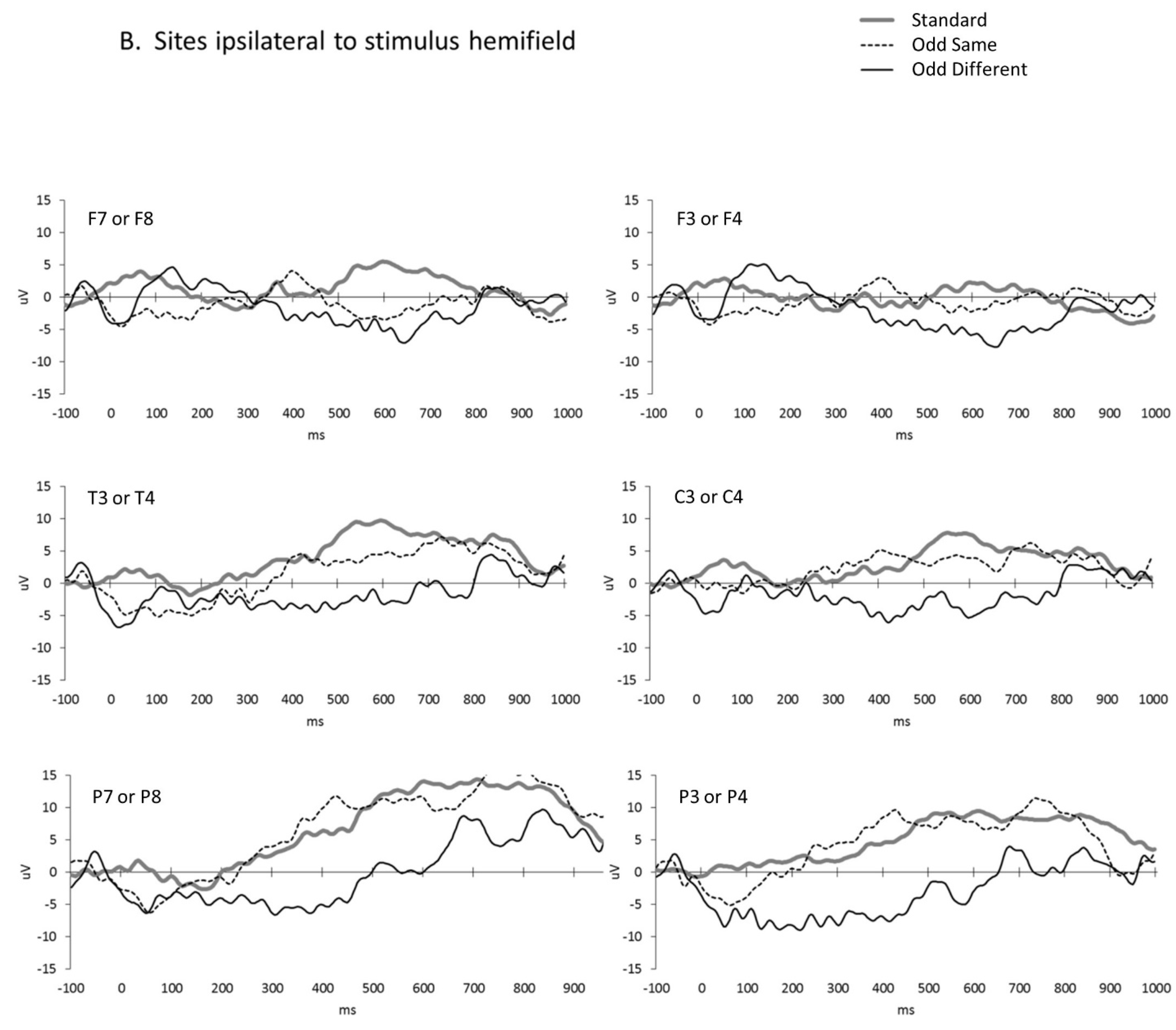 Brainsci 13 00647 g002b