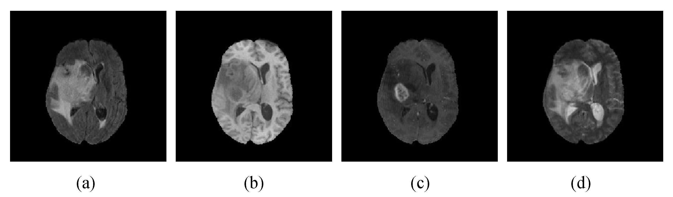 Brainsci 13 00650 g005 Brainsci 13 00650 g005
