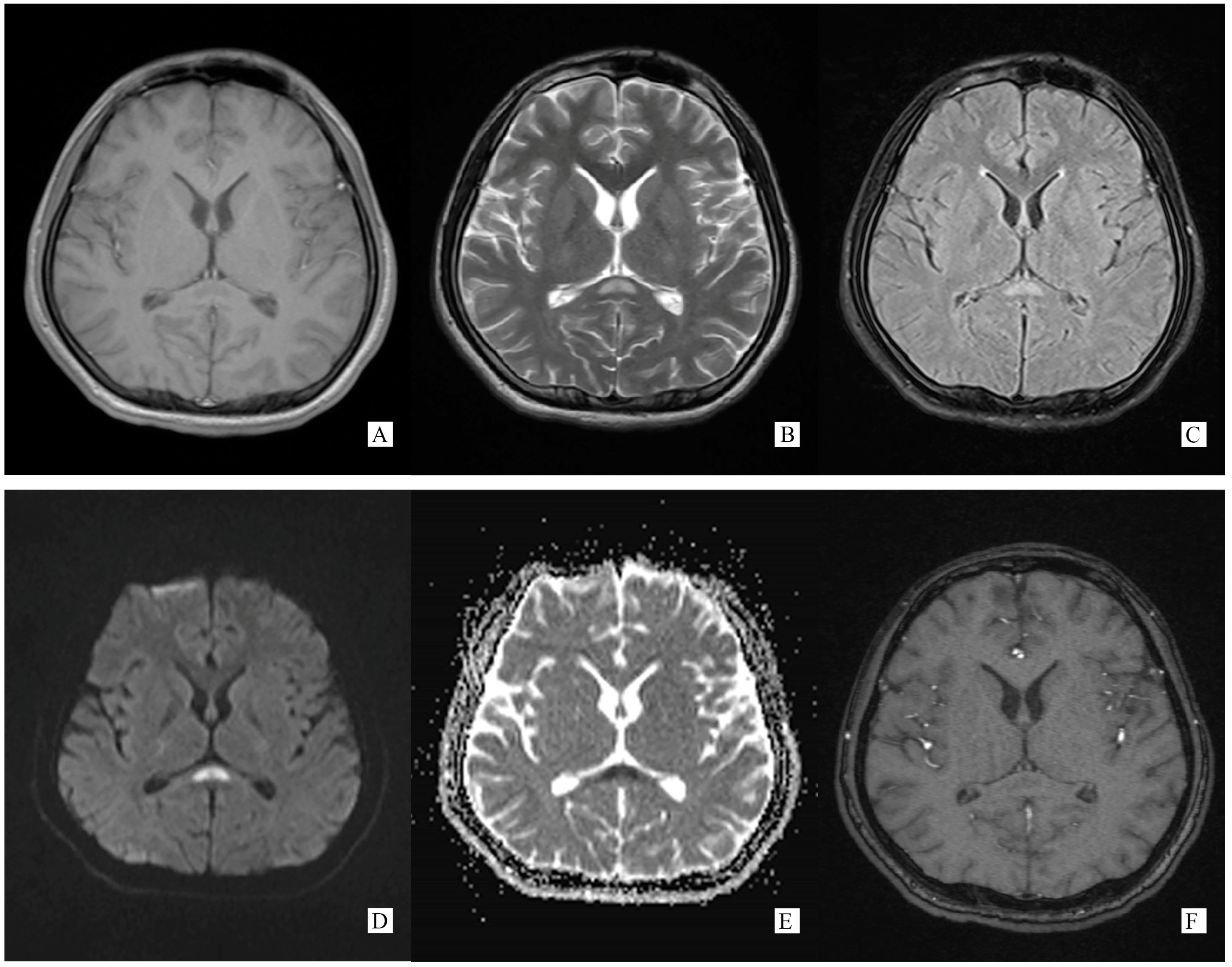 Brainsci 13 00659 g001
