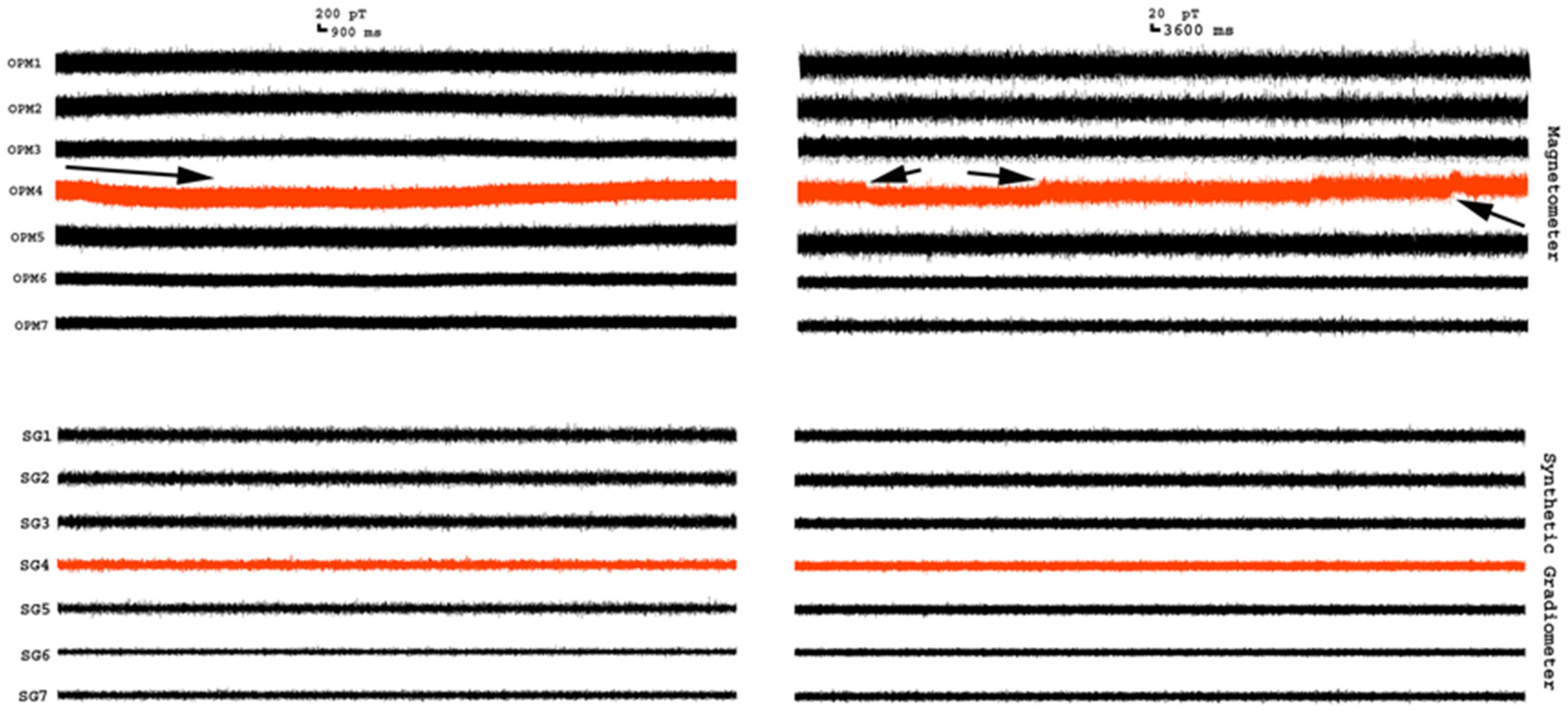 Brainsci 13 00663 g004