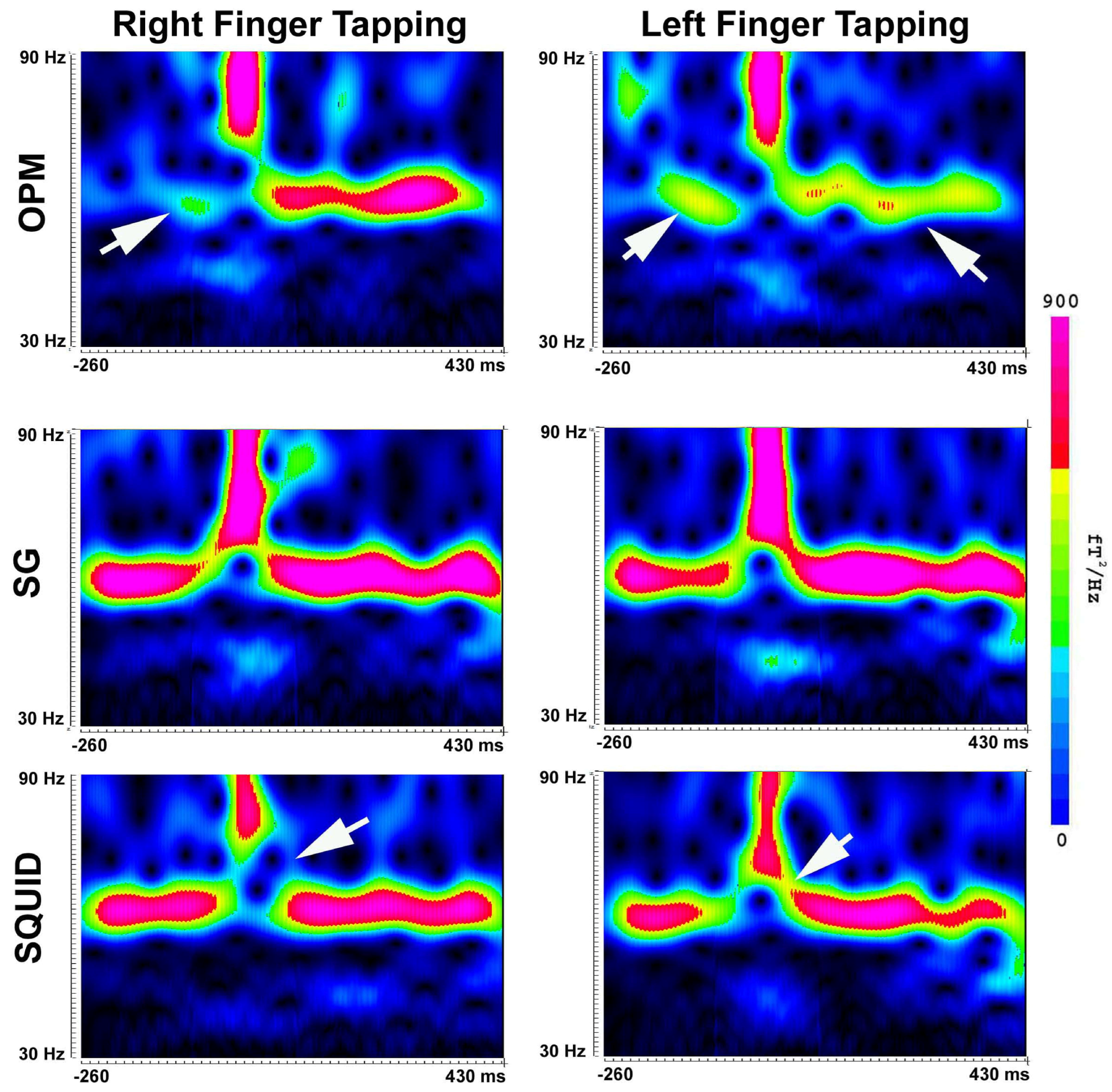 Brainsci 13 00663 g010