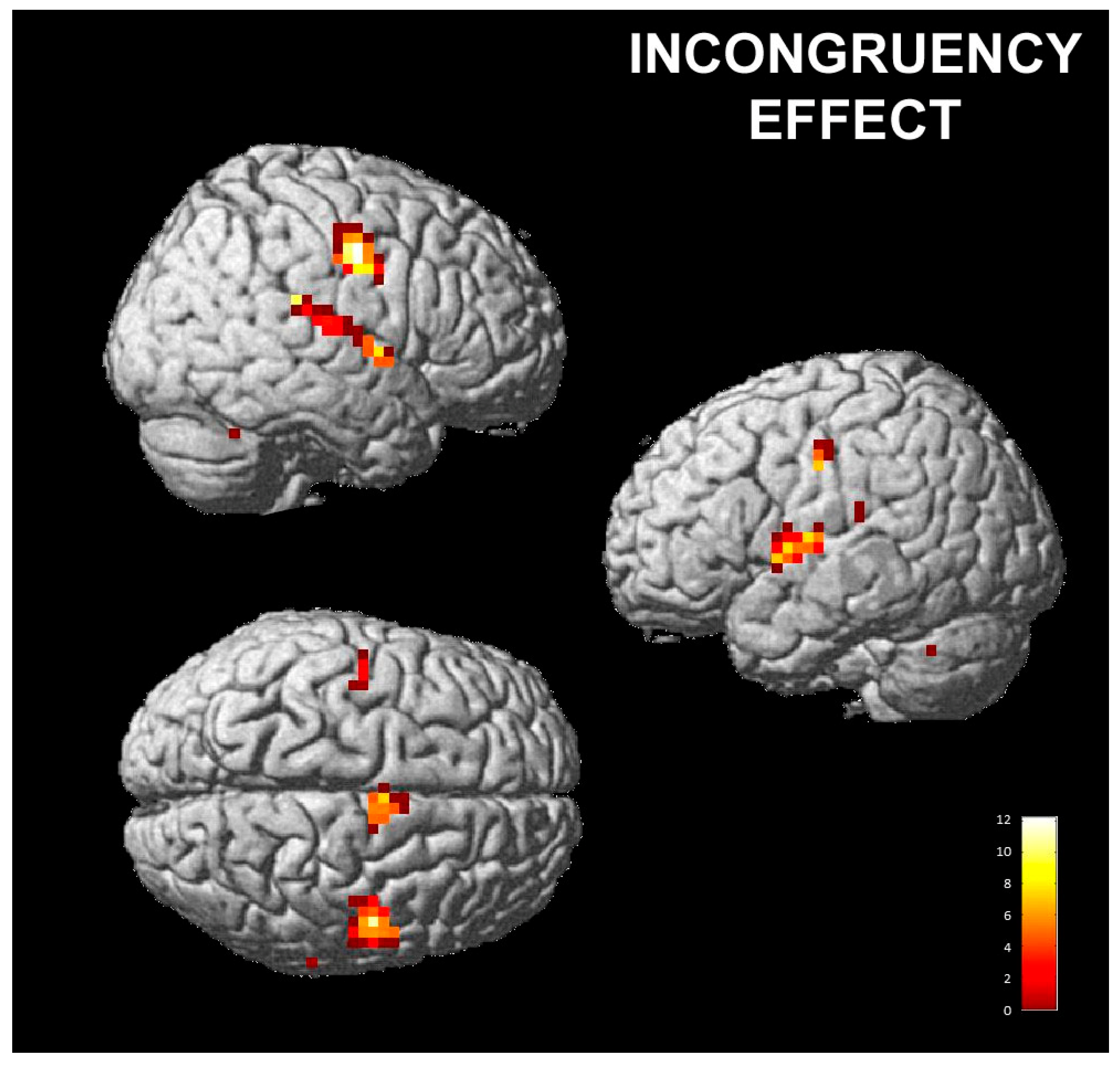 Brainsci 13 00668 g003