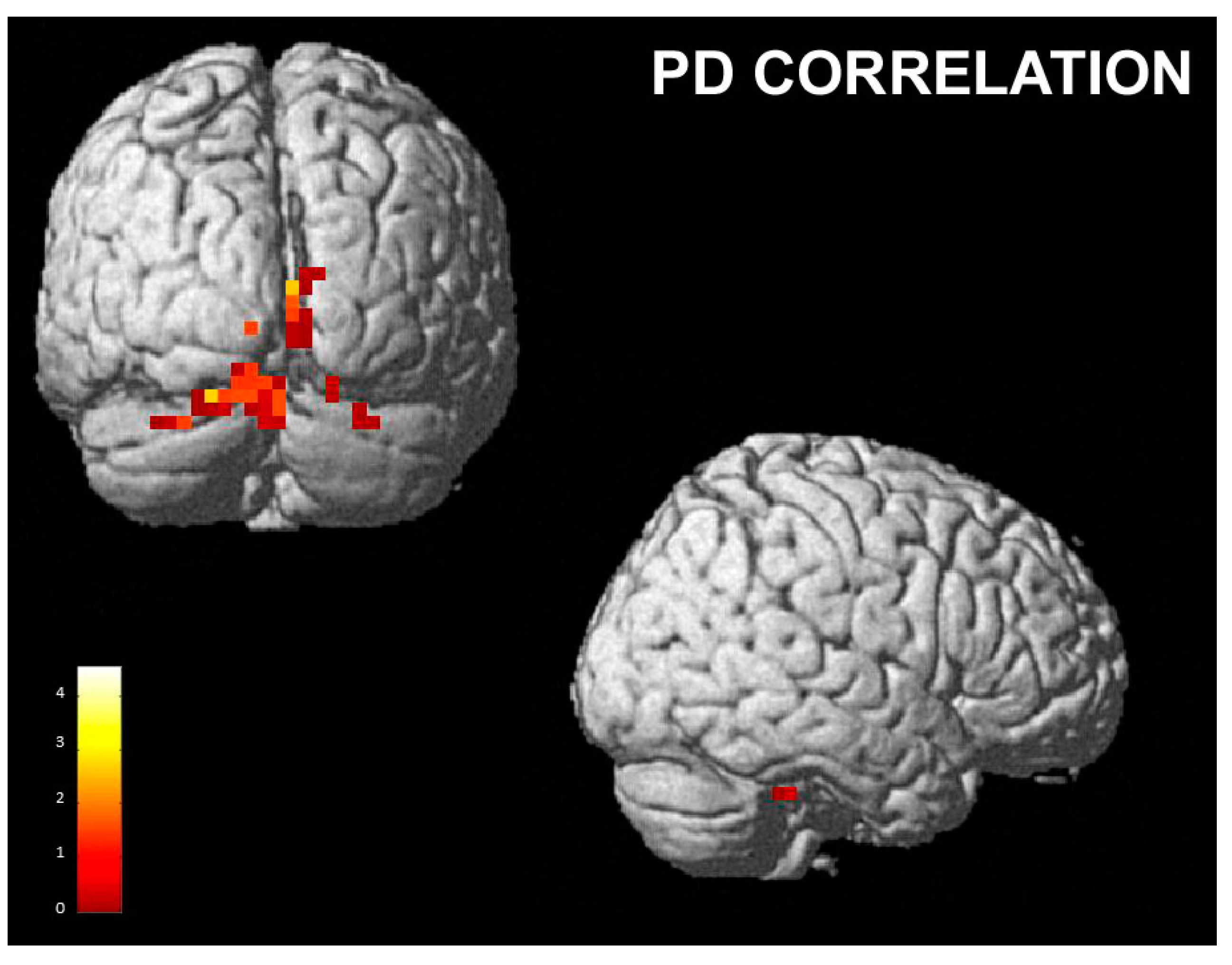 Brainsci 13 00668 g006