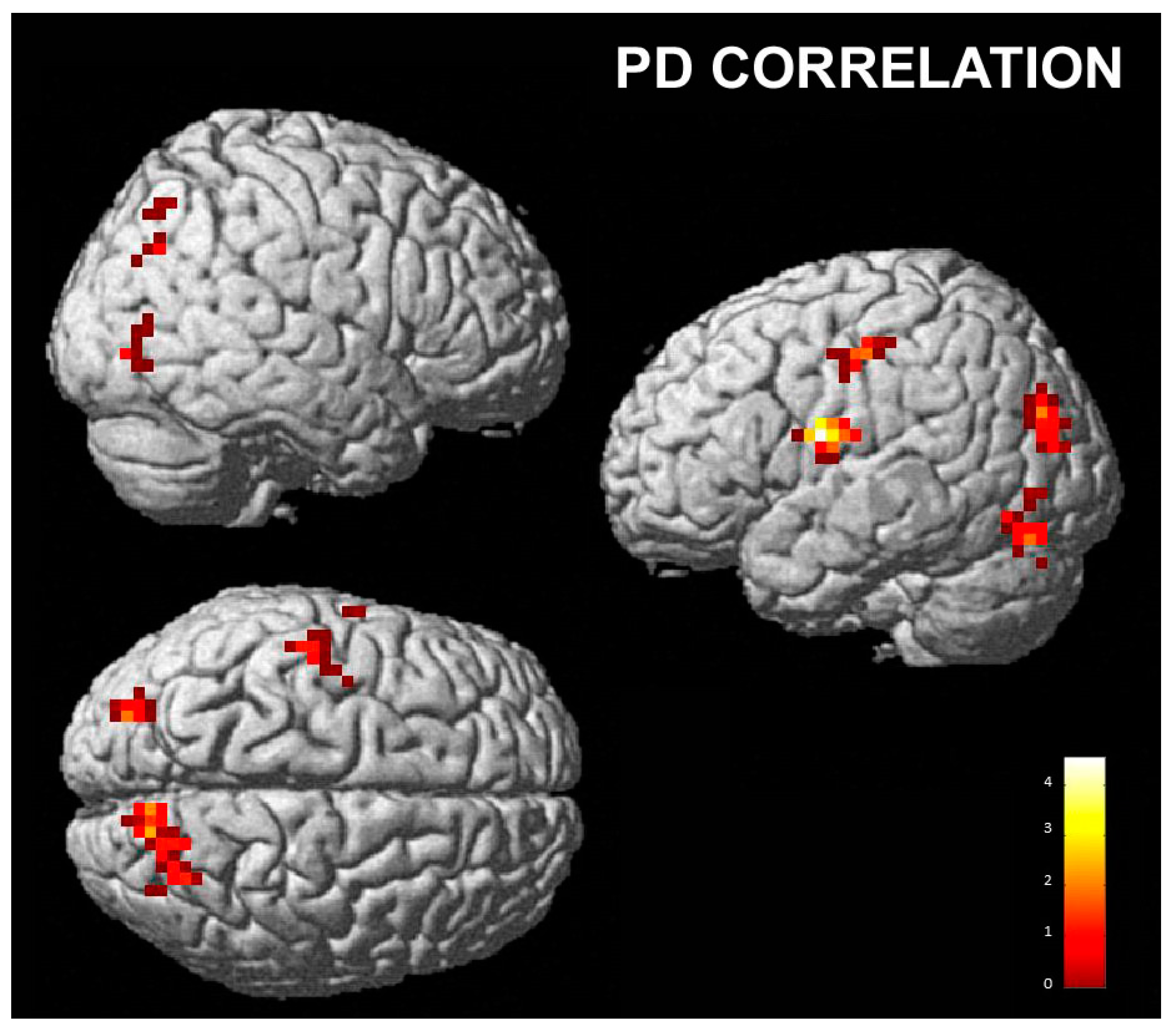Brainsci 13 00668 g007