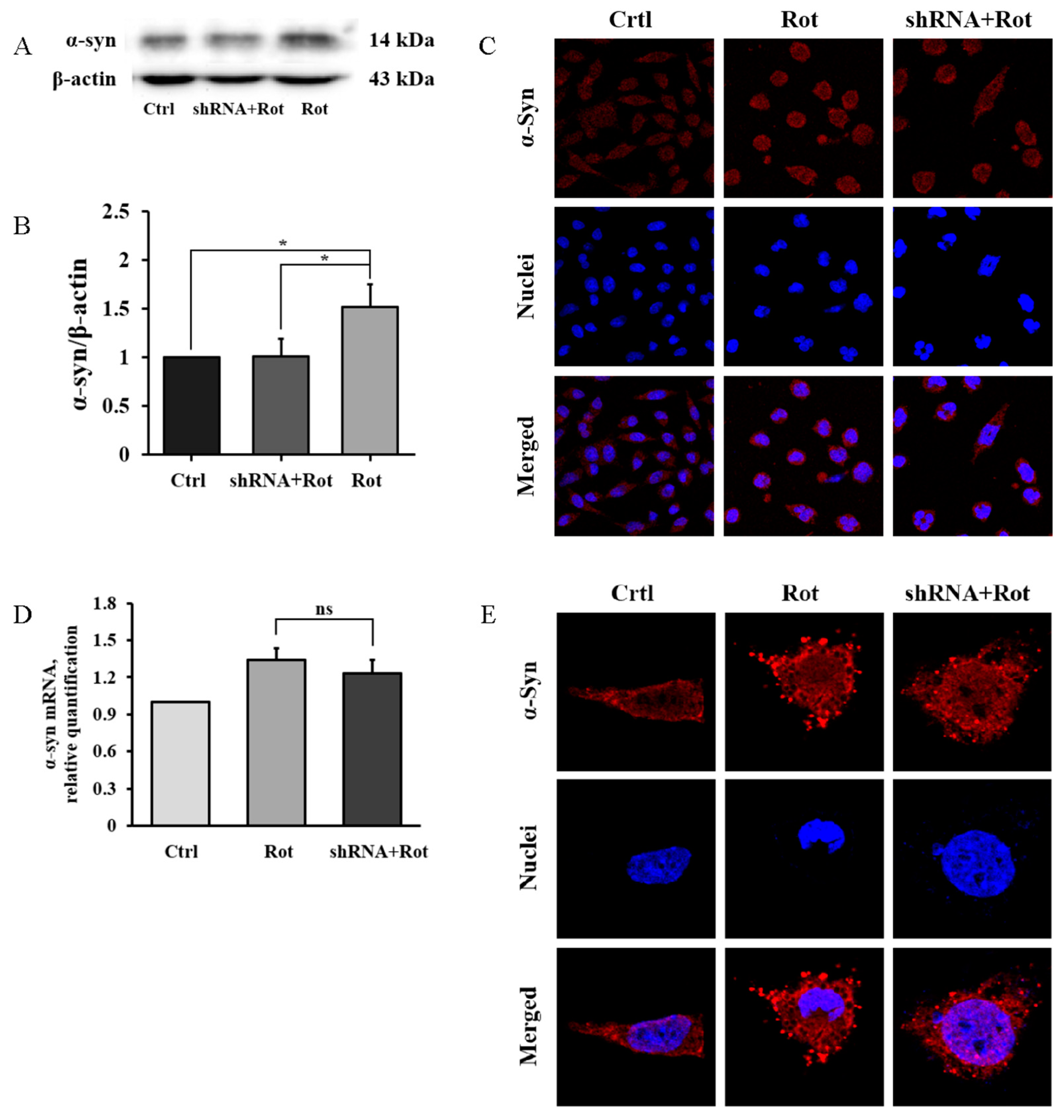Brainsci 13 00670 g005