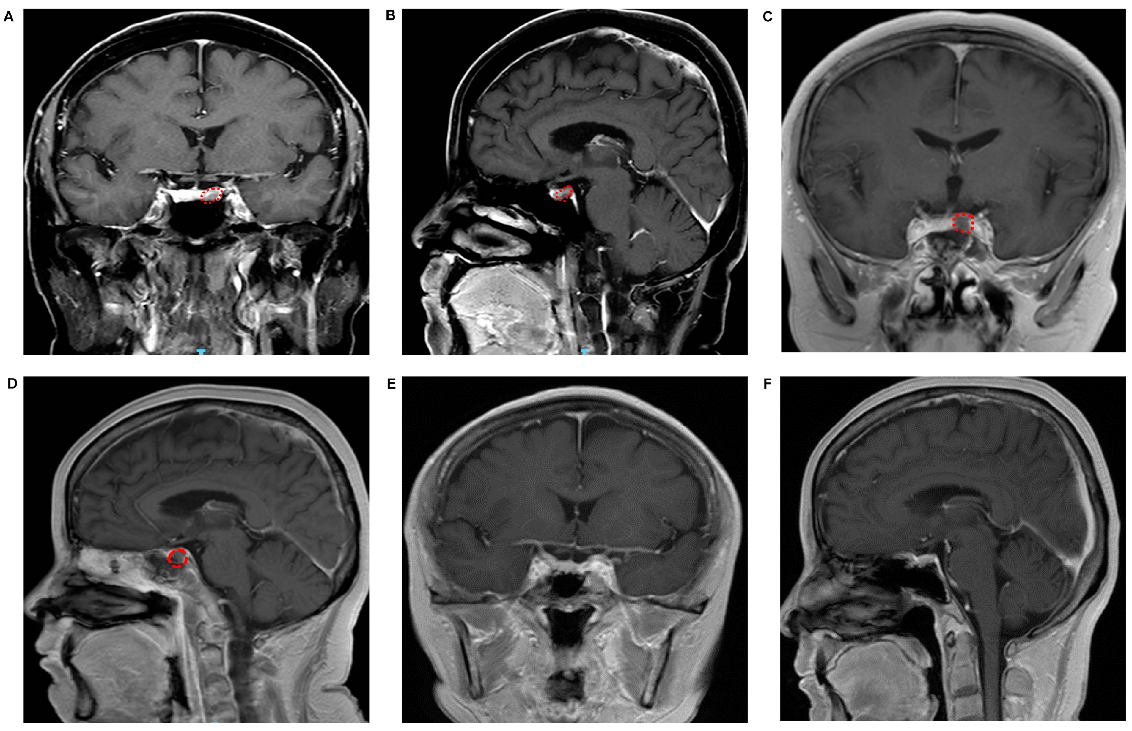 Brainsci 13 00671 g001