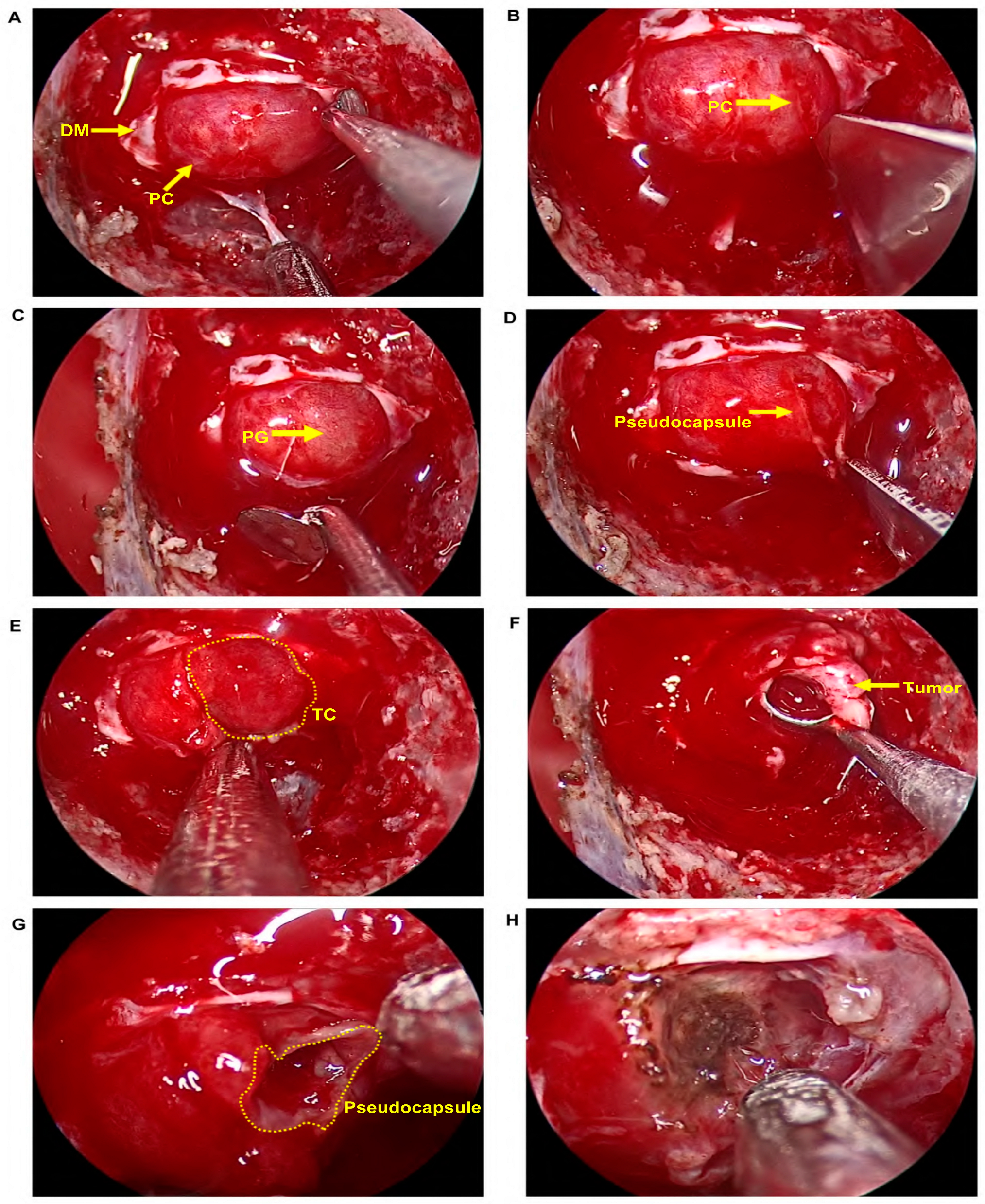 Brainsci 13 00671 g002
