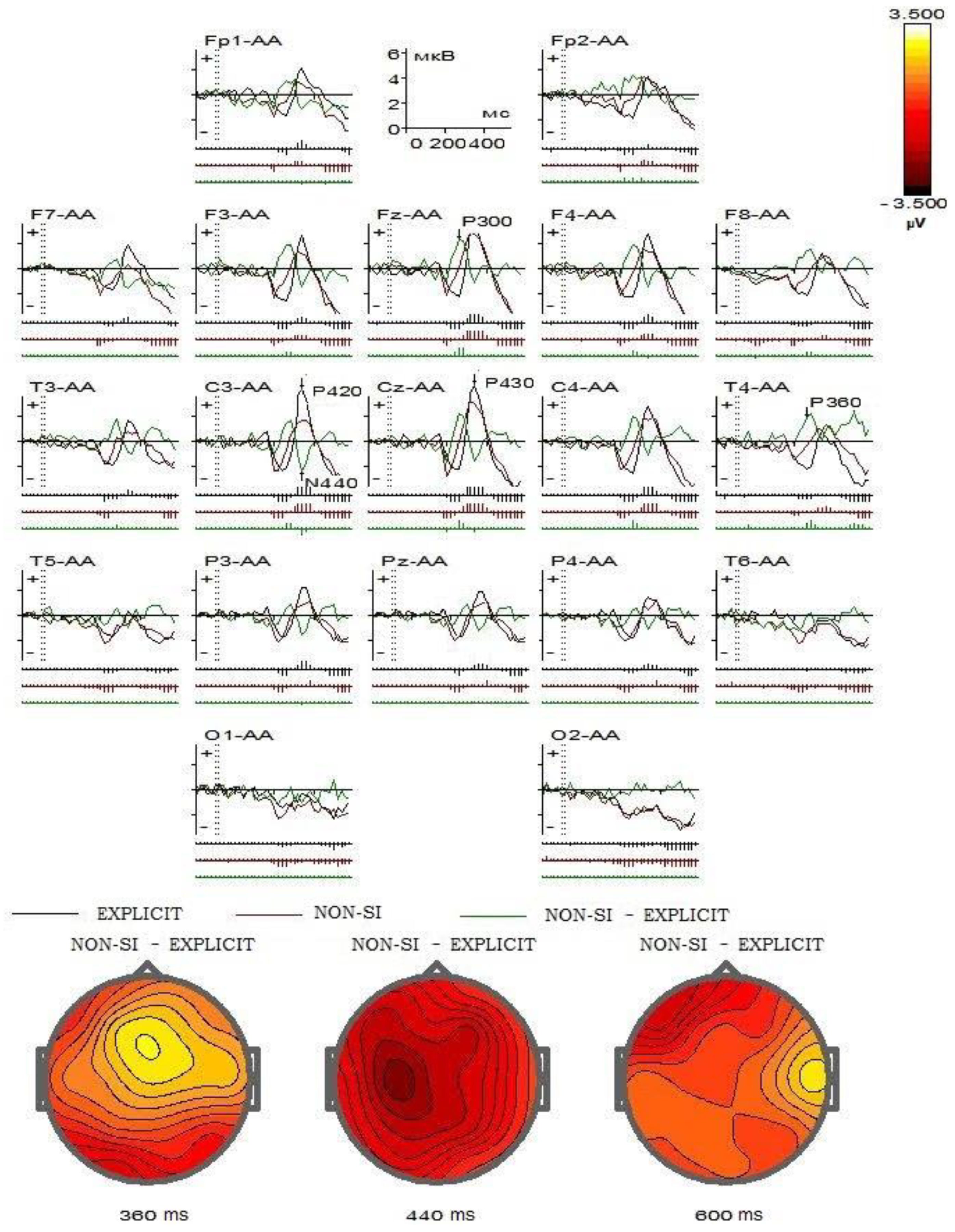 Brainsci 13 00681 g003