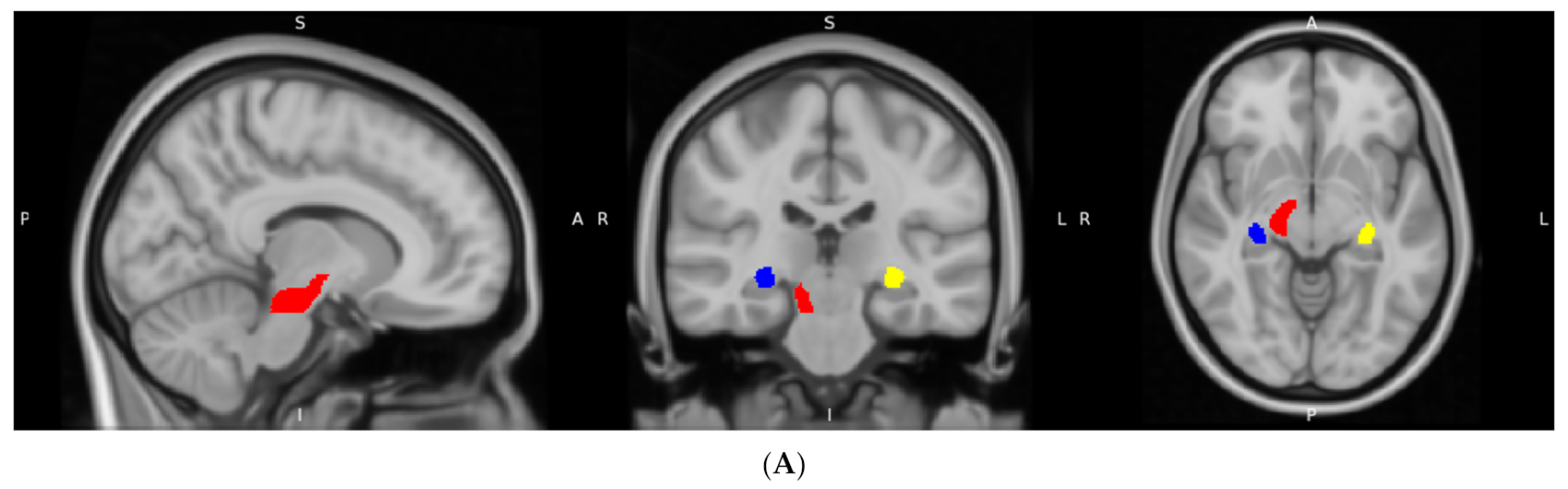 Brainsci 13 00691 g003a Brainsci 13 00691 g003a