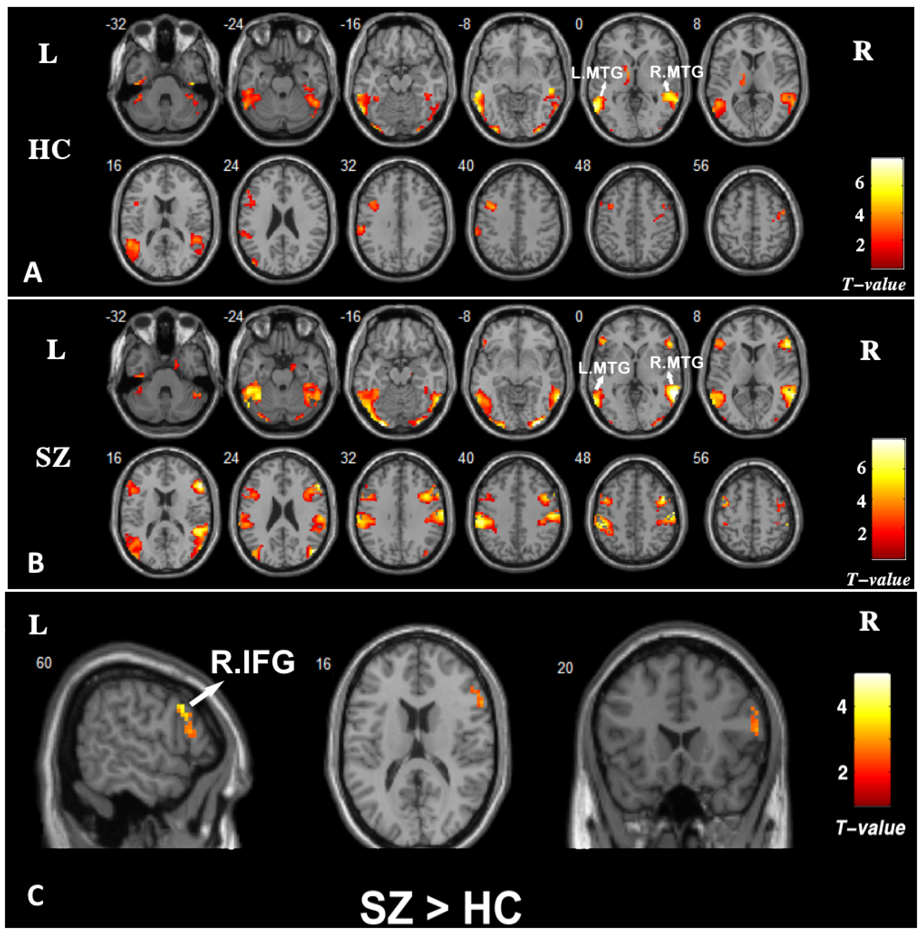 Brainsci 13 00692 g003 Brainsci 13 00692 g003