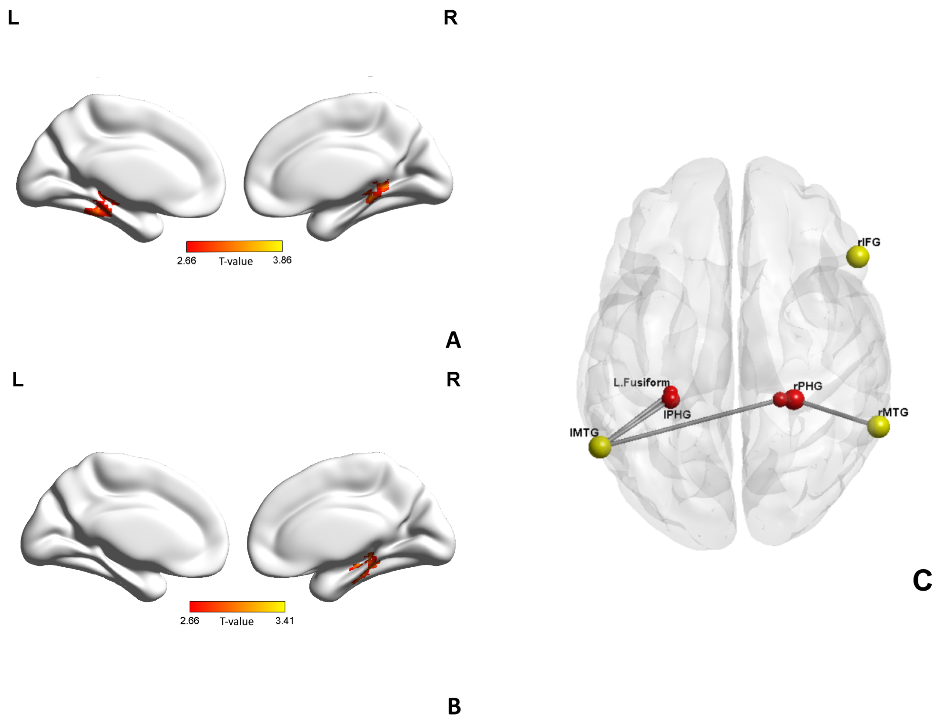 Brainsci 13 00692 g004 Brainsci 13 00692 g004