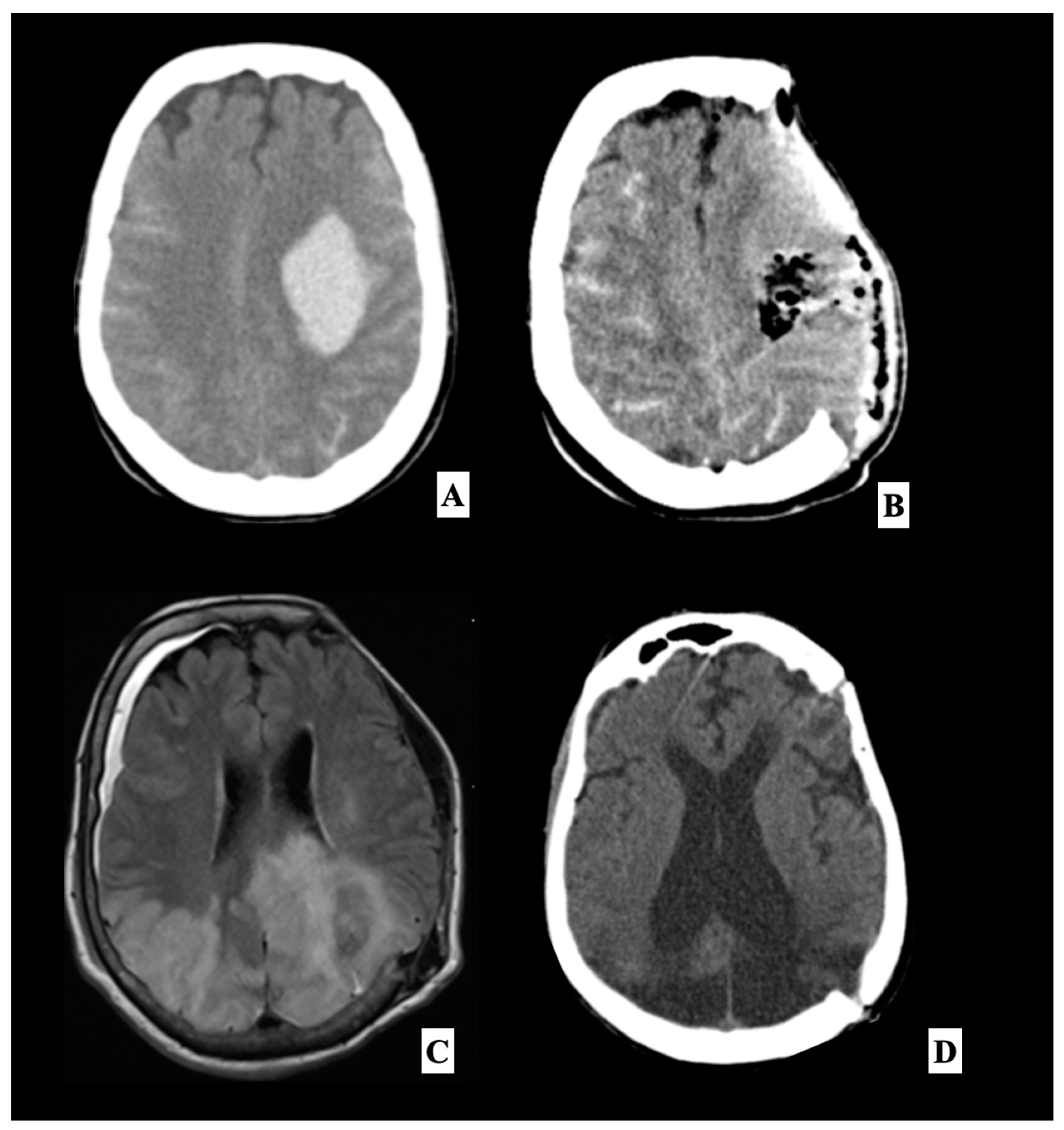 Brainsci 13 00706 g002