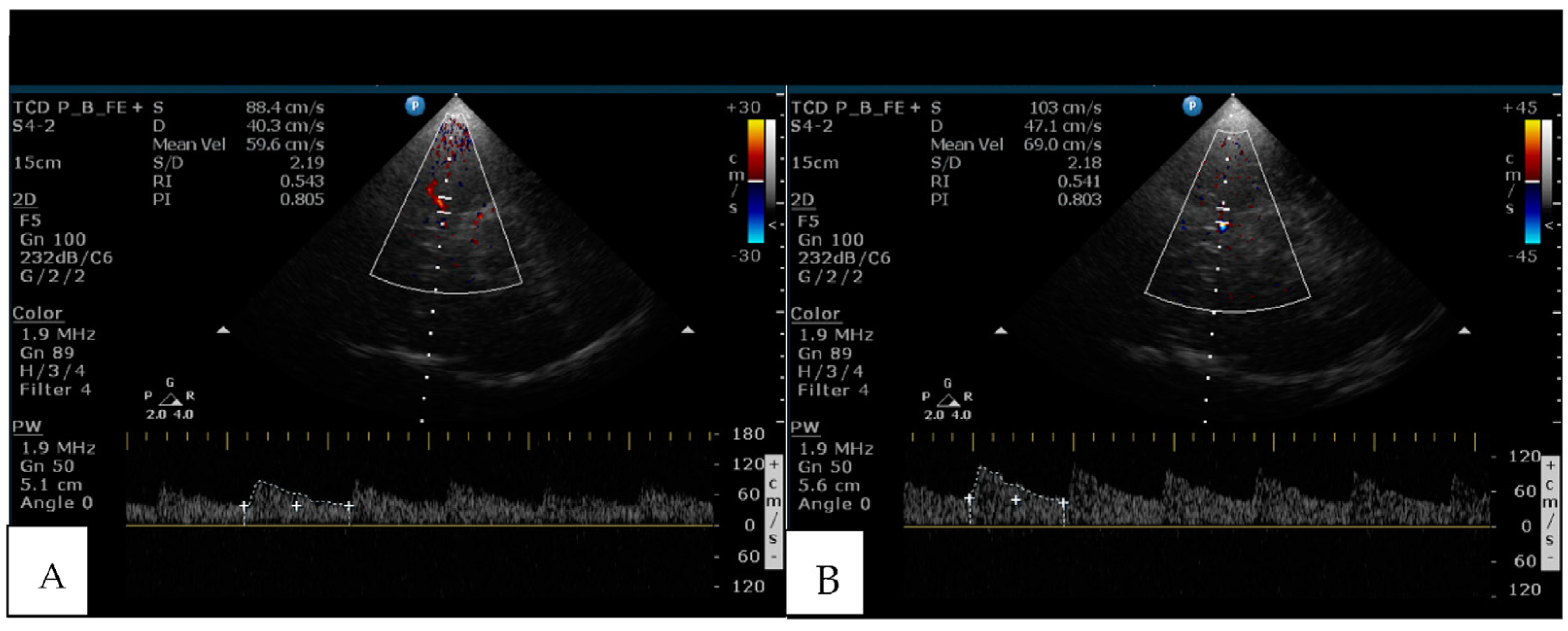 Brainsci 13 00709 g001