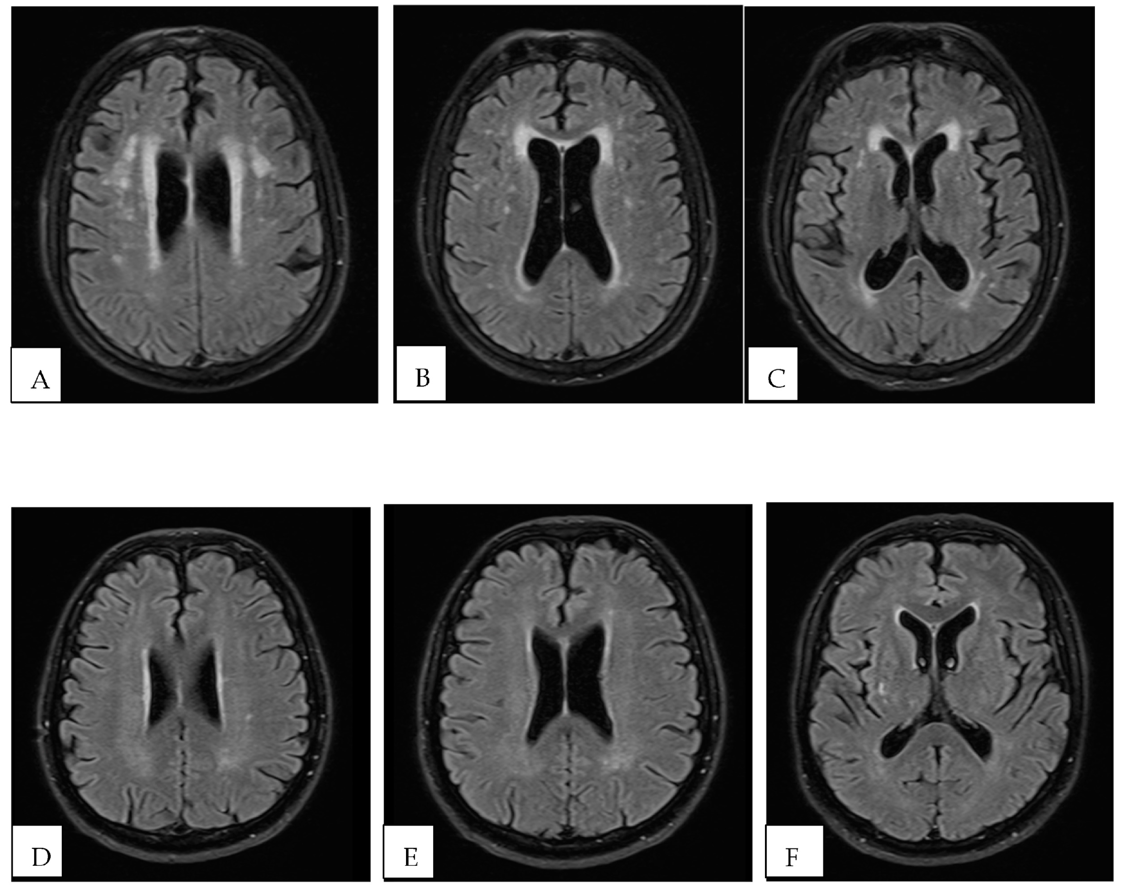 Brainsci 13 00709 g002