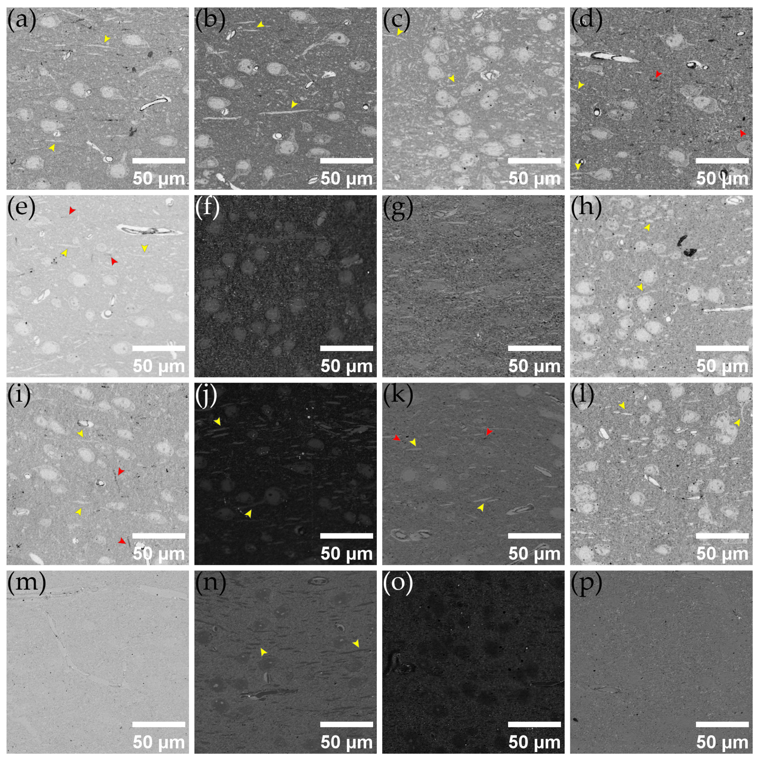 Brainsci 13 00711 g008