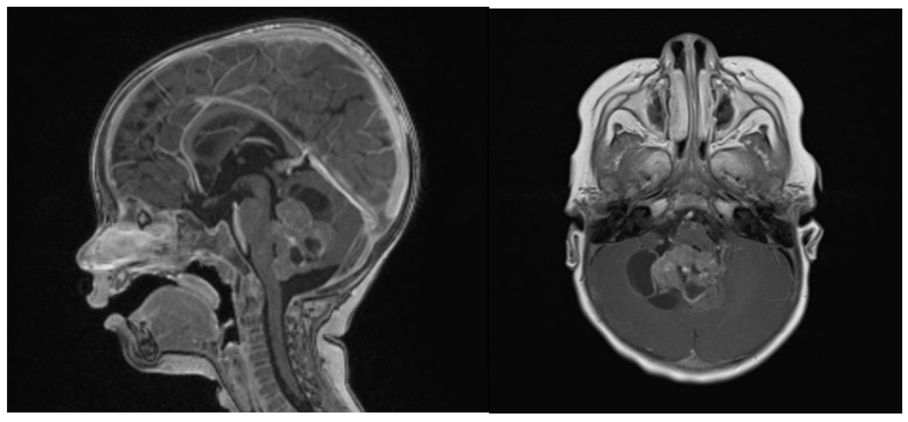 Brainsci 13 00712 g002