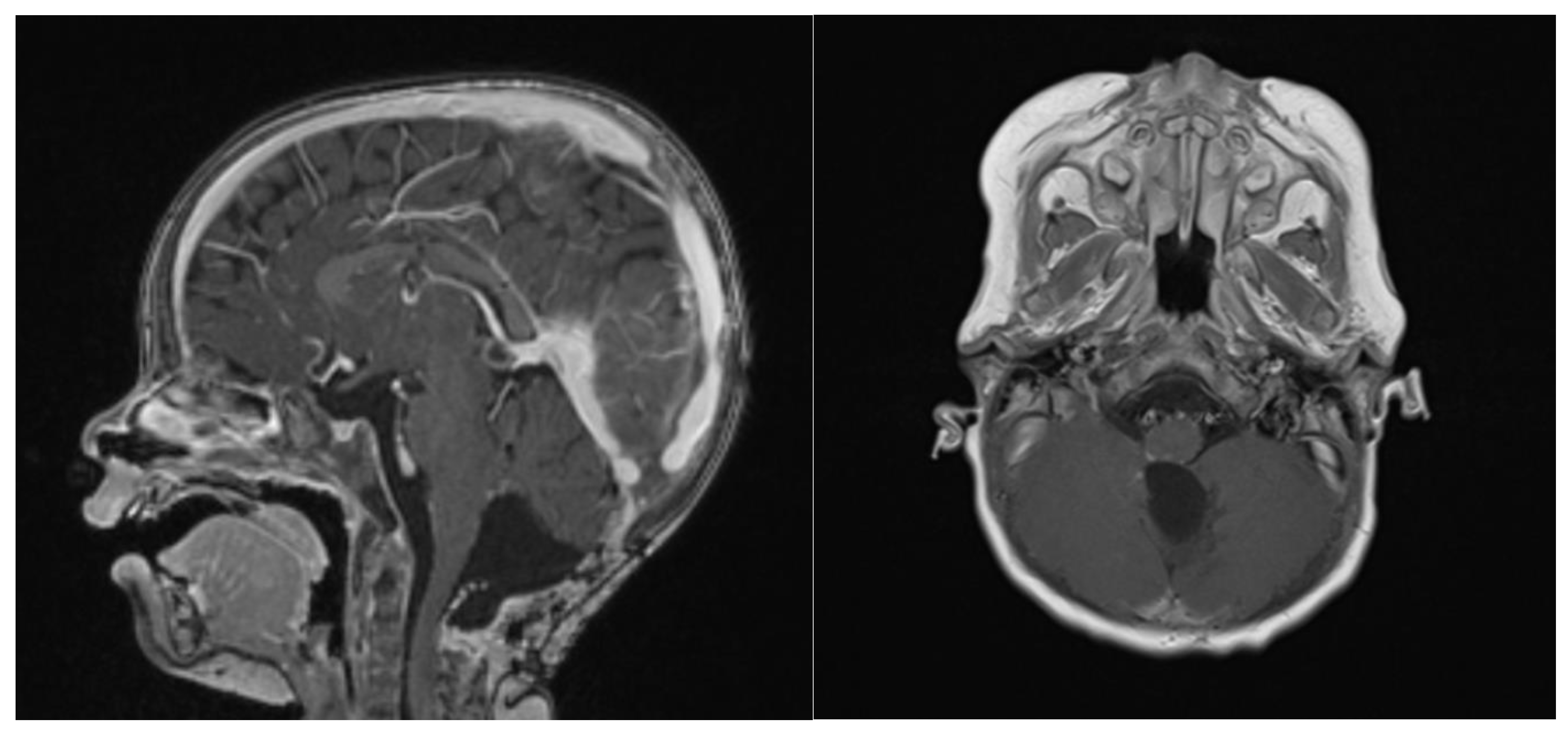 Brainsci 13 00712 g007