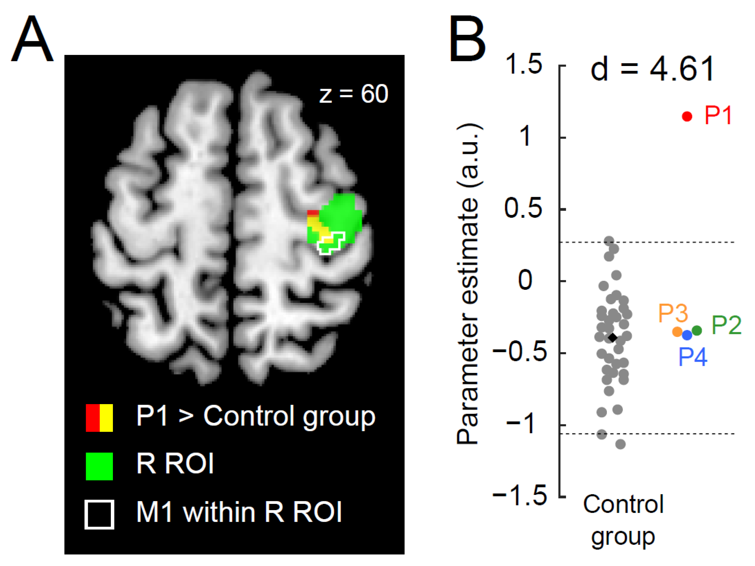 Brainsci 13 00715 g002