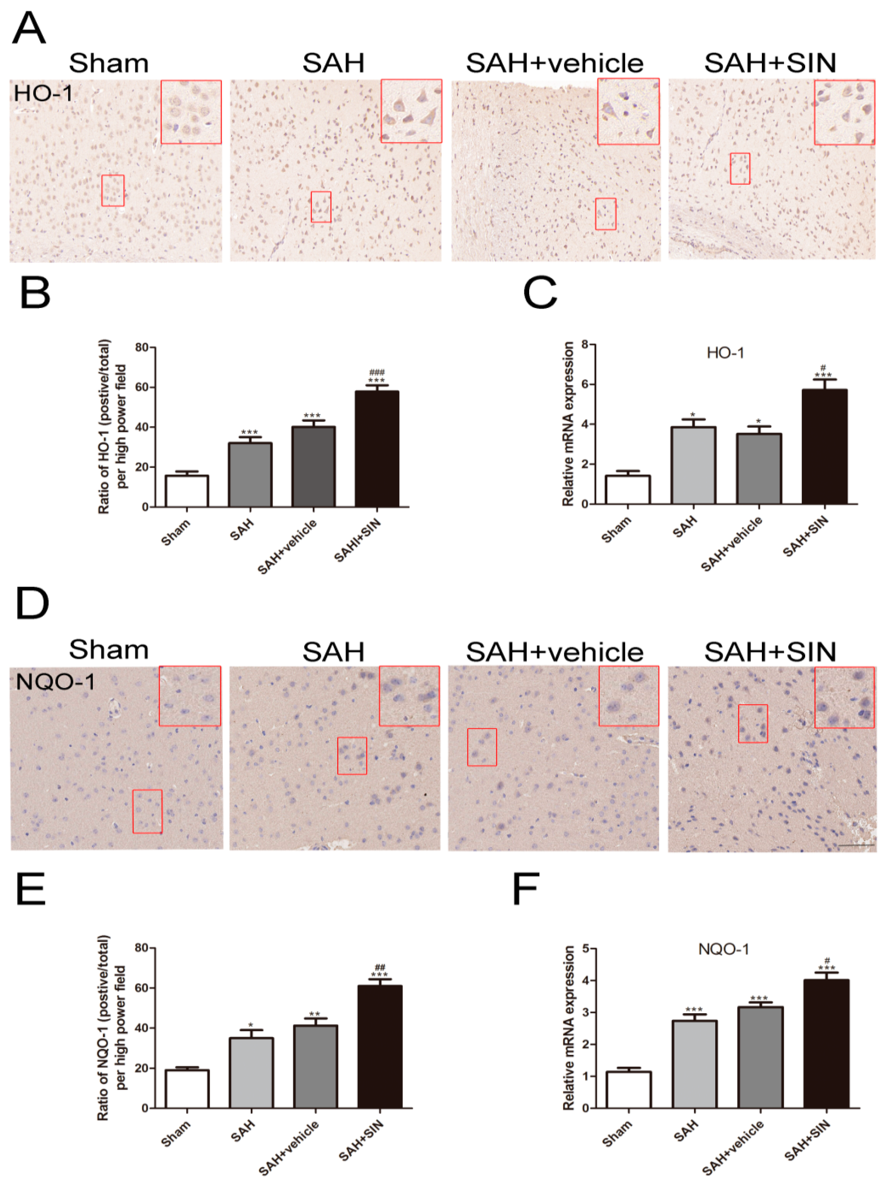Brainsci 13 00716 g006