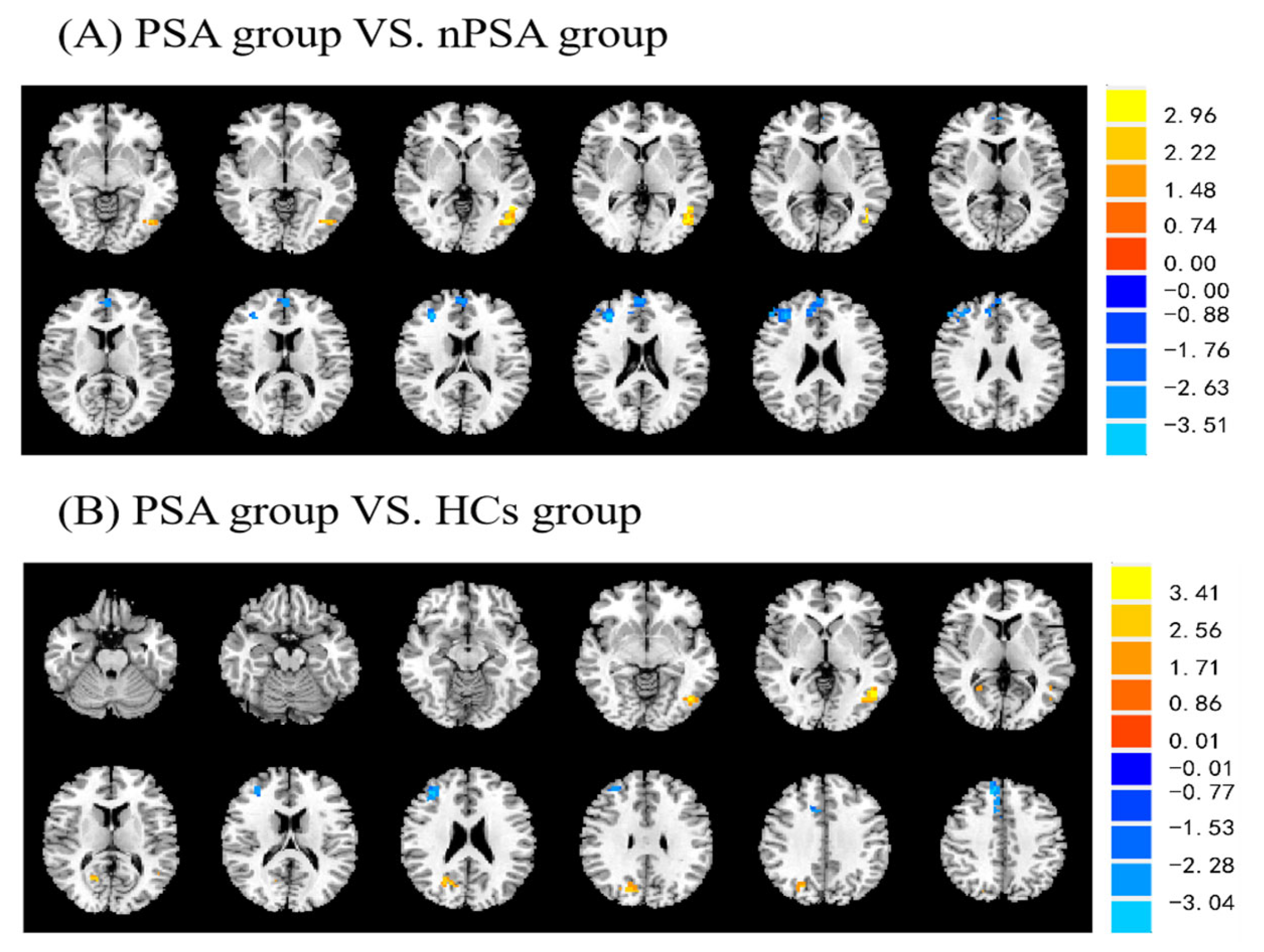 Brainsci 13 00730 g001 Brainsci 13 00730 g001