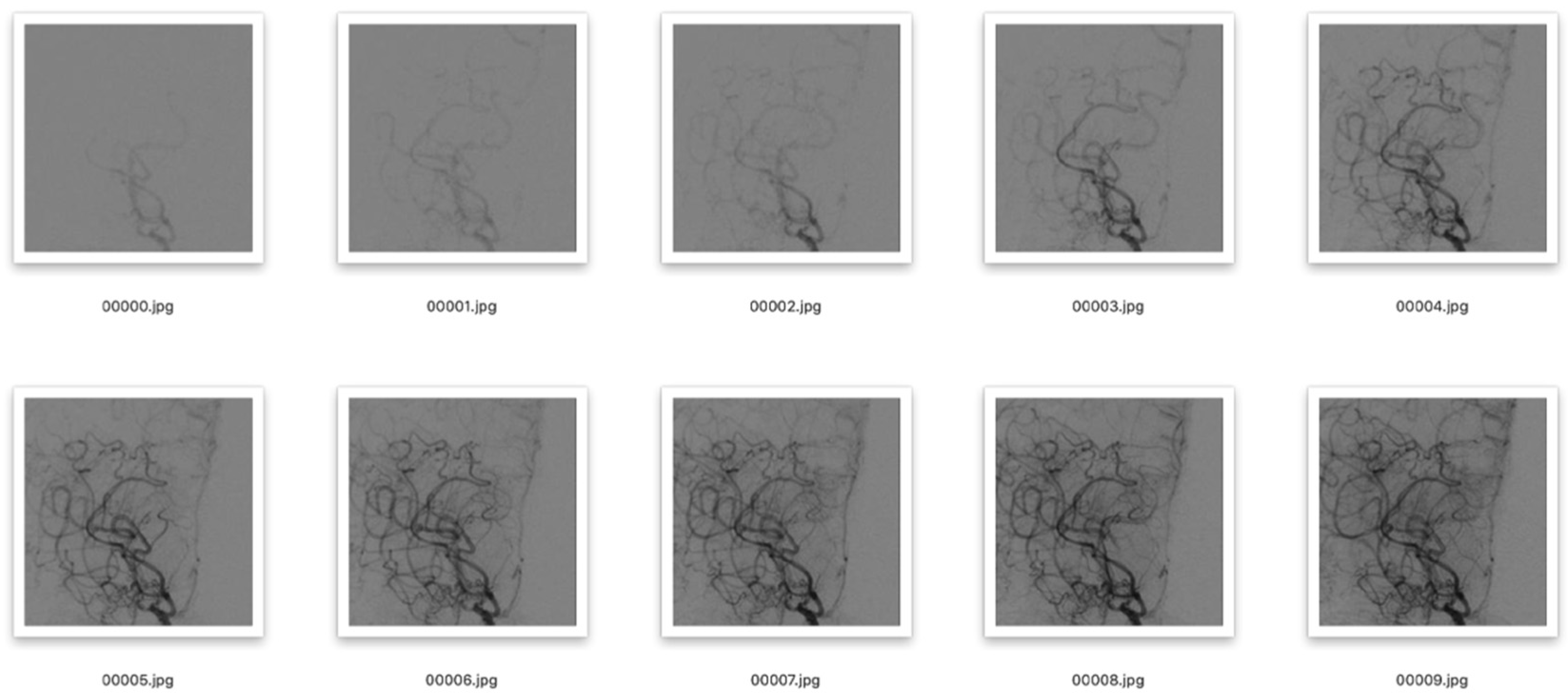 Brainsci 13 00742 g001 Brainsci 13 00742 g001