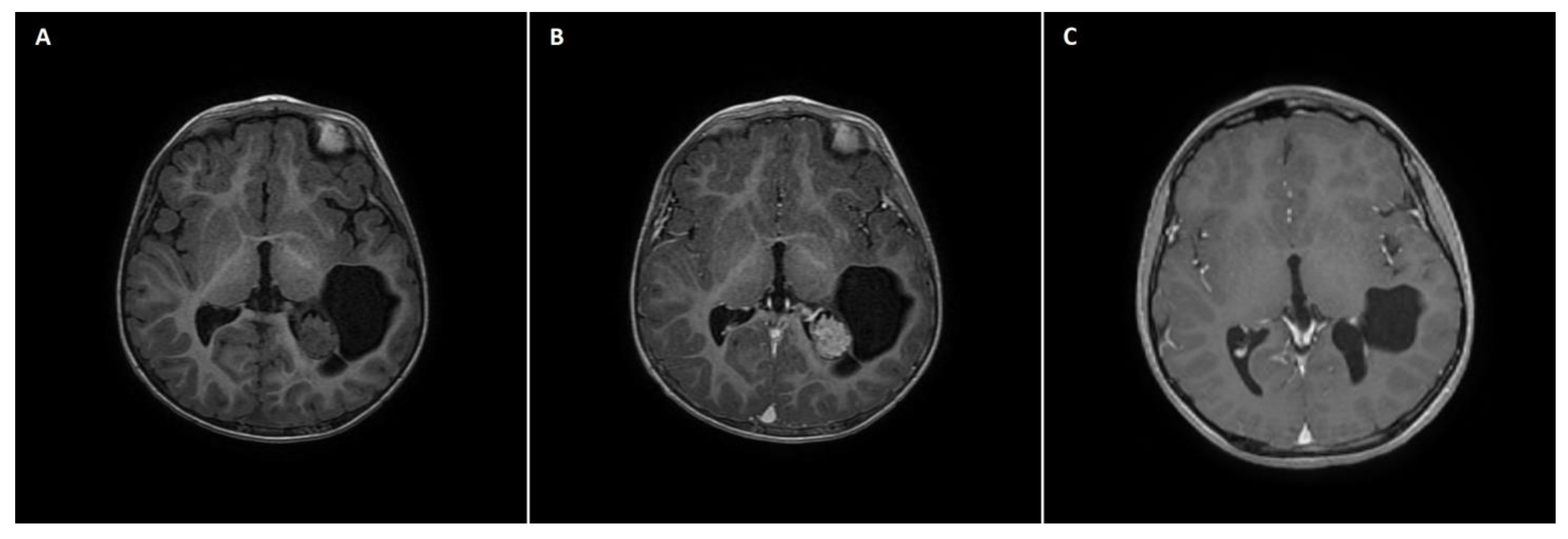 Brainsci 13 00746 g002