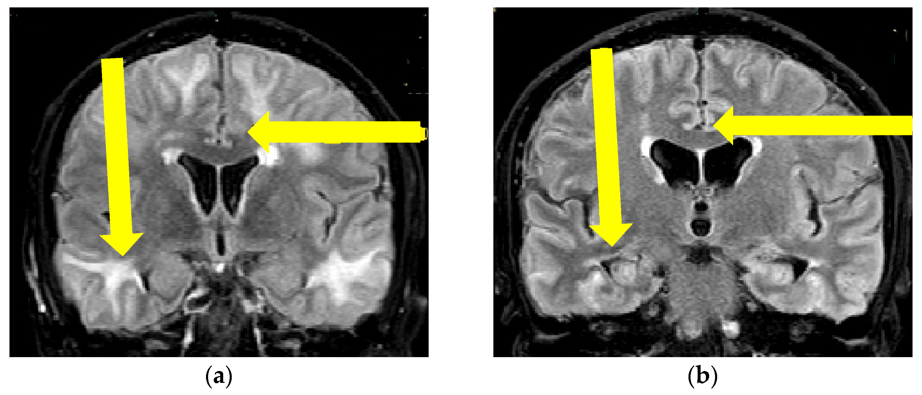 Brainsci 13 00747 g002