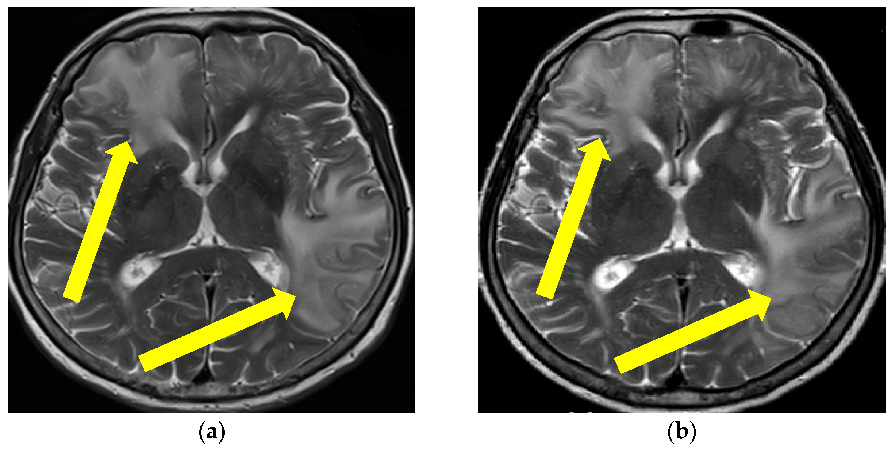 Brainsci 13 00747 g003