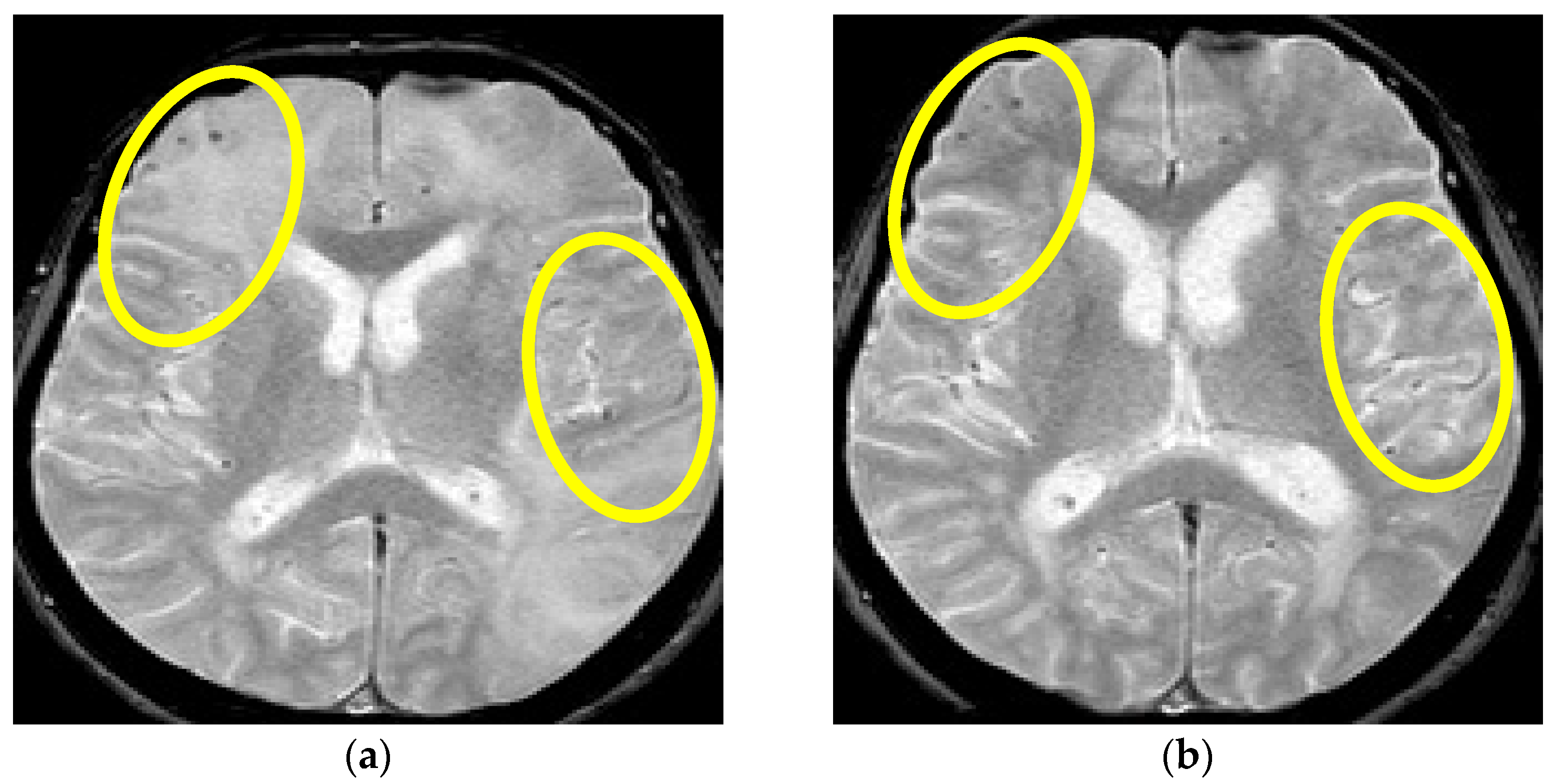 Brainsci 13 00747 g004