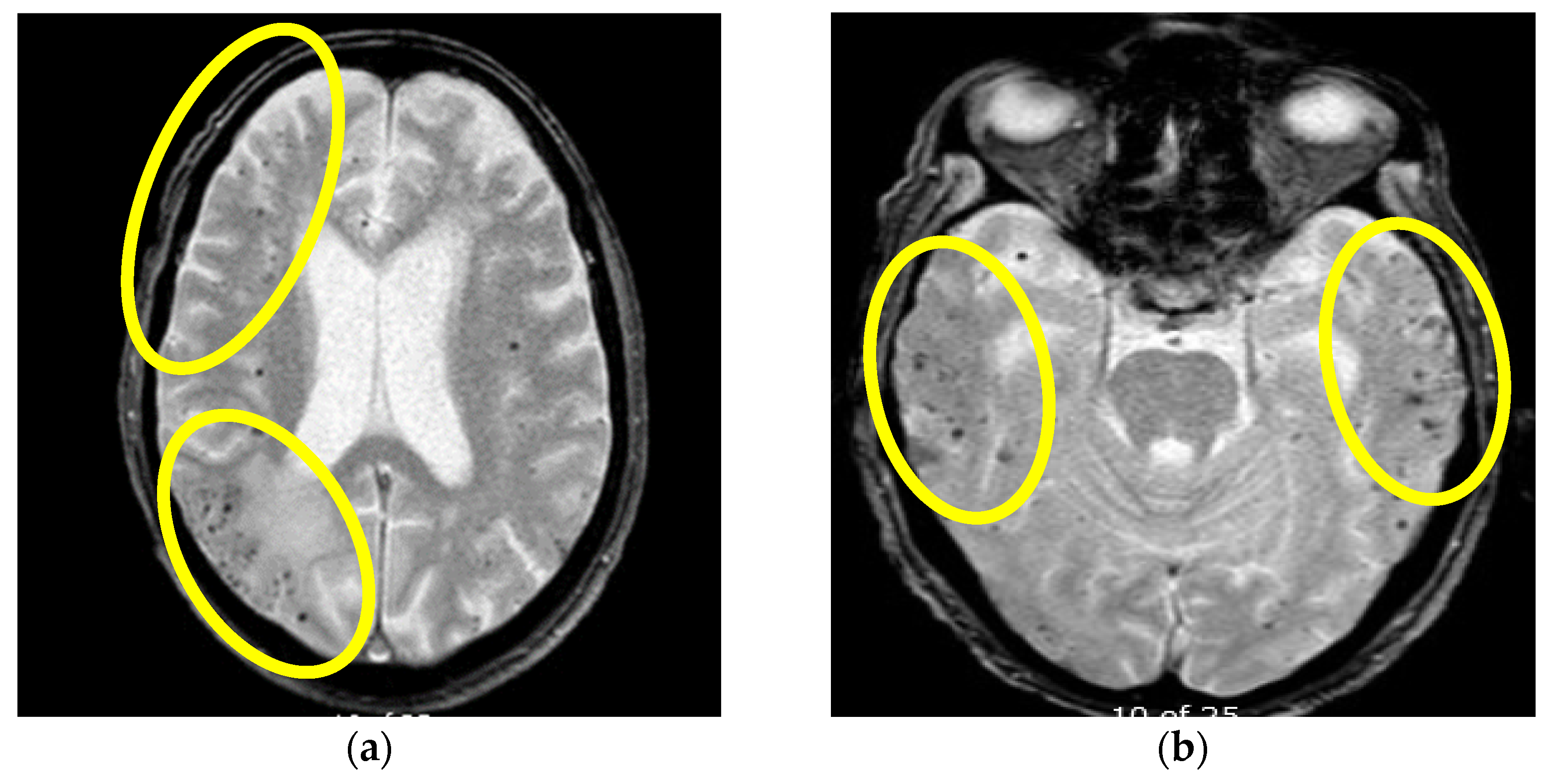 Brainsci 13 00747 g005