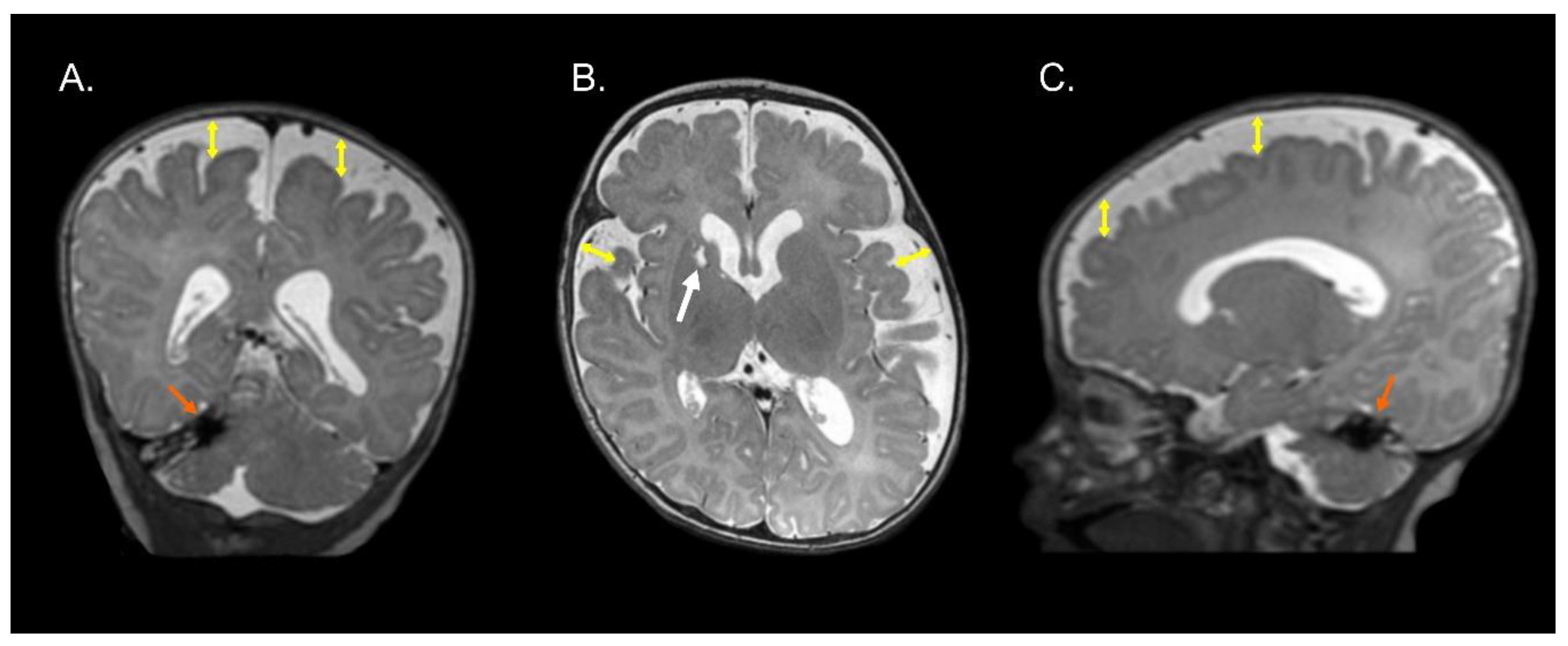 Brainsci 13 00753 g001