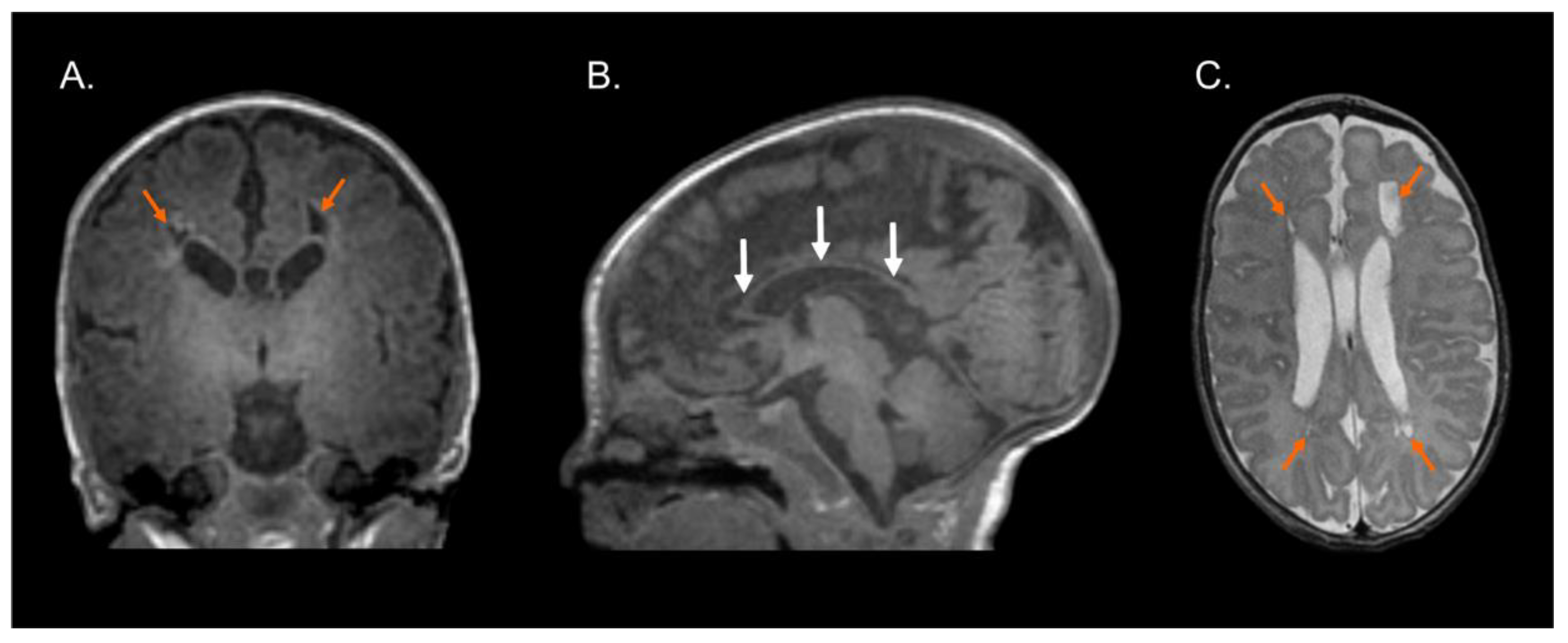 Brainsci 13 00753 g002