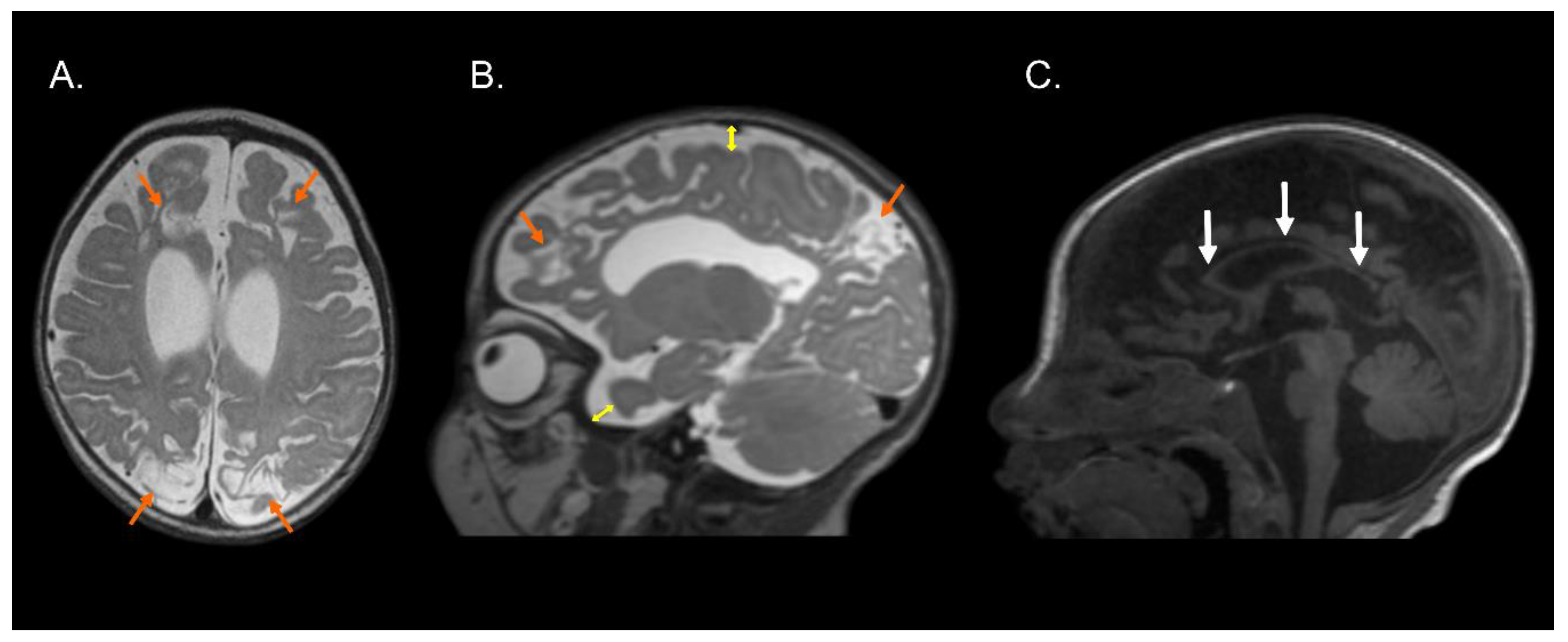 Brainsci 13 00753 g003