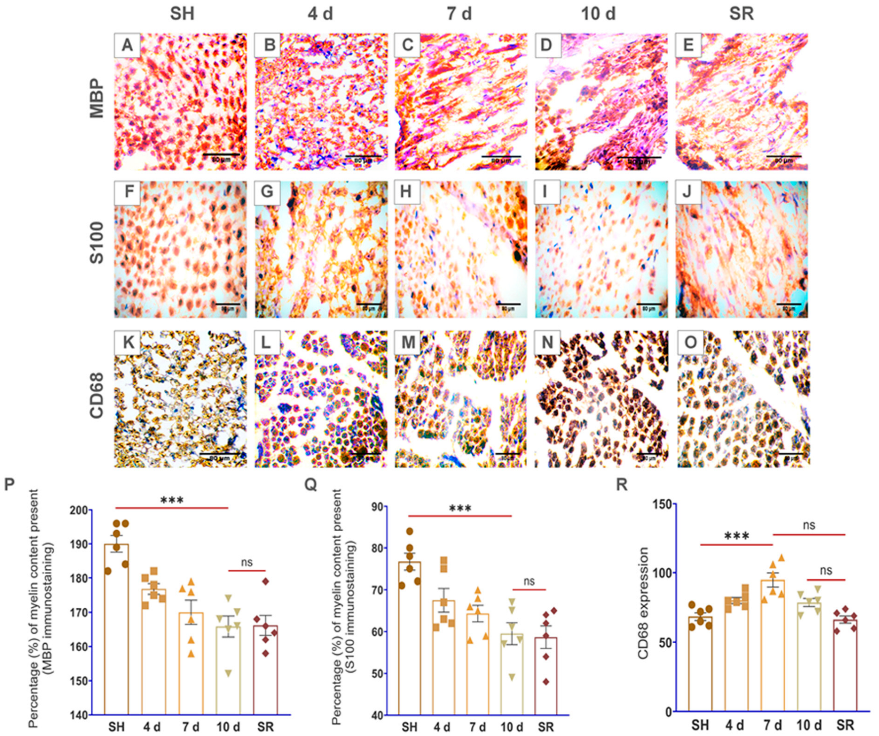 Brainsci 13 00754 g003